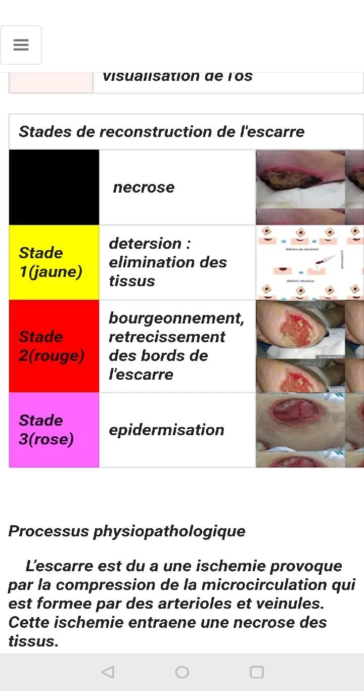 Nursing care -Technical sheets | Indus Appstore | Screenshot