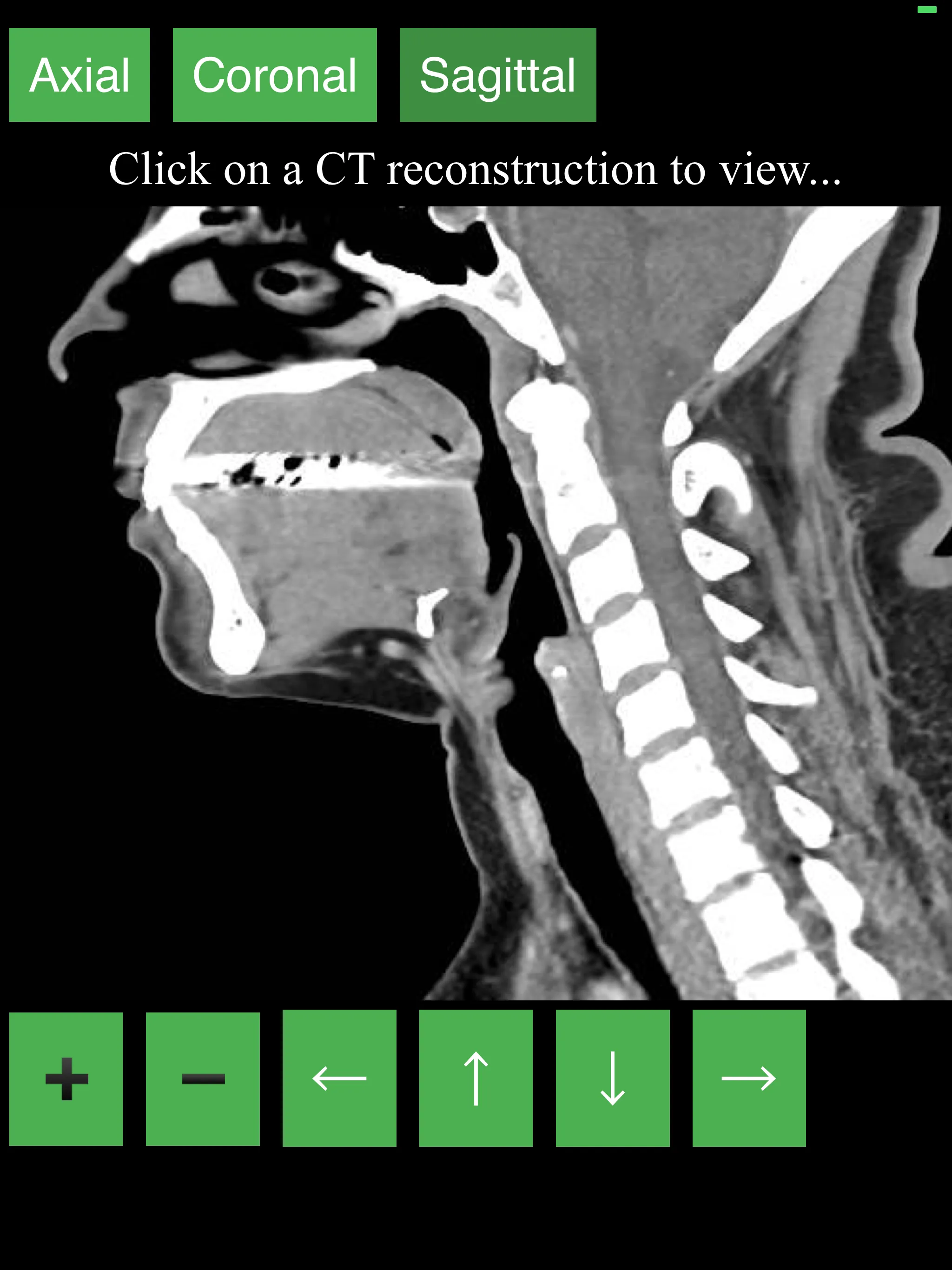 CT Neck | Indus Appstore | Screenshot