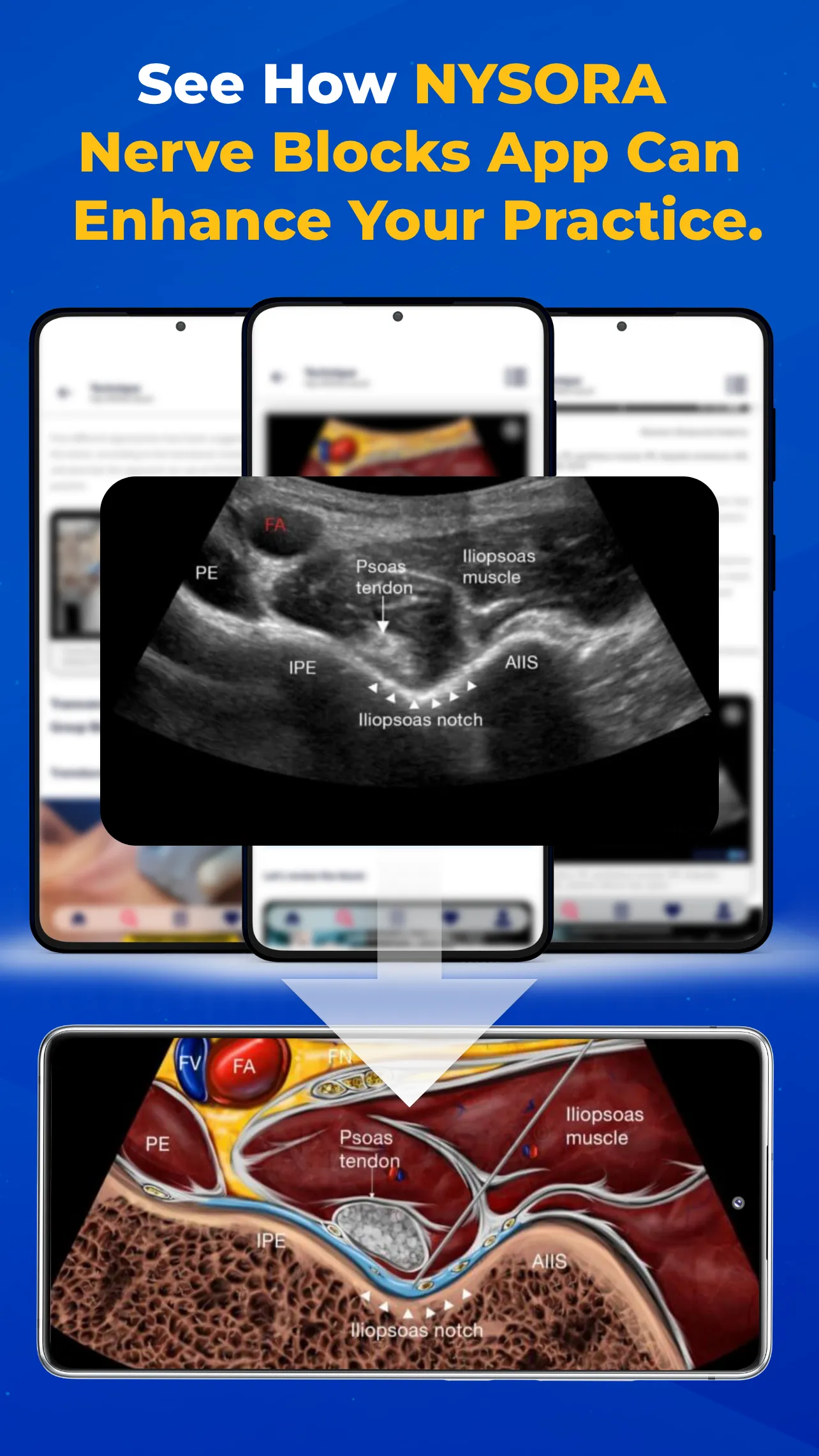NYSORA Nerve Blocks | Indus Appstore | Screenshot