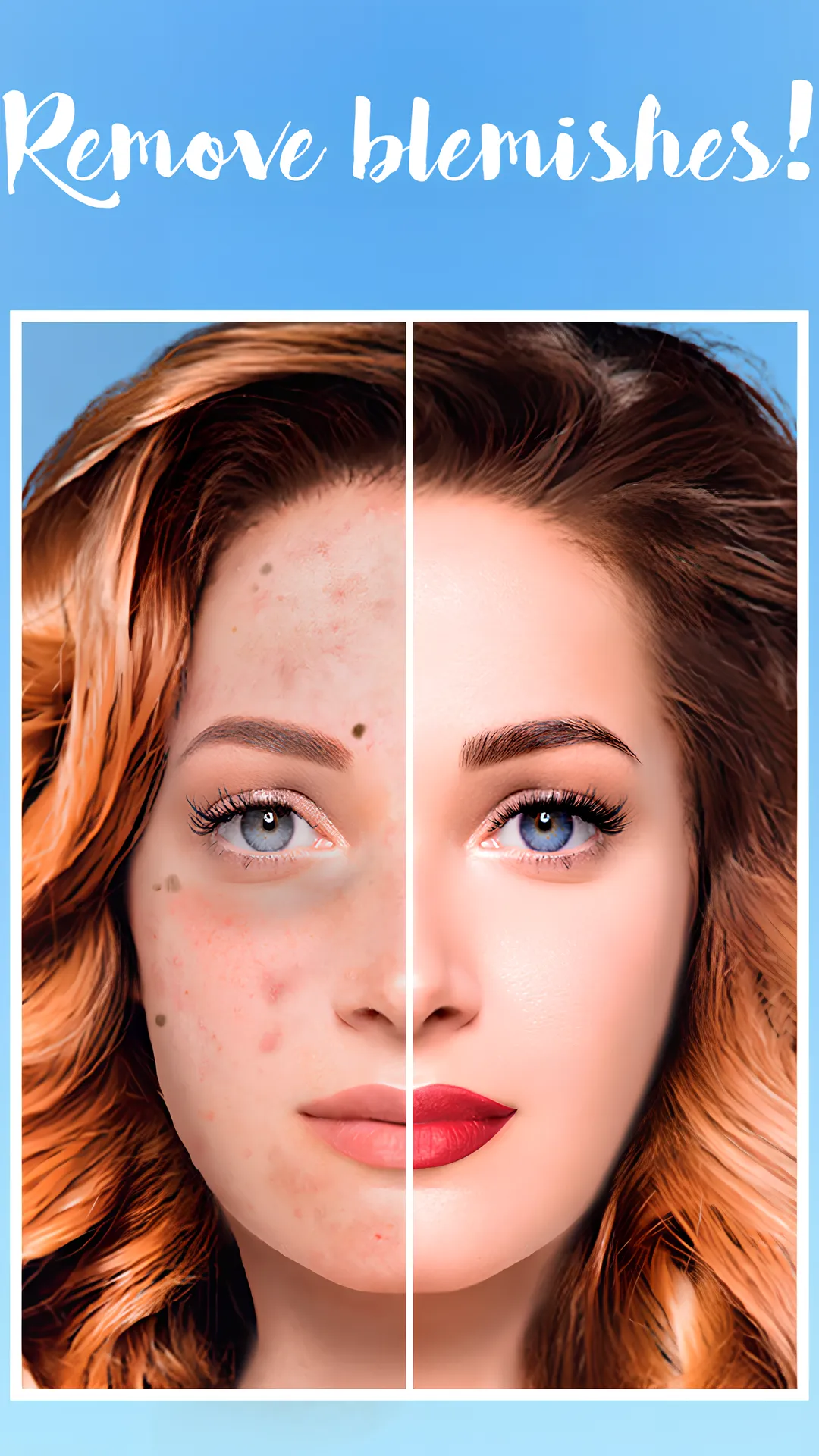 Blemishes Removal | Indus Appstore | Screenshot