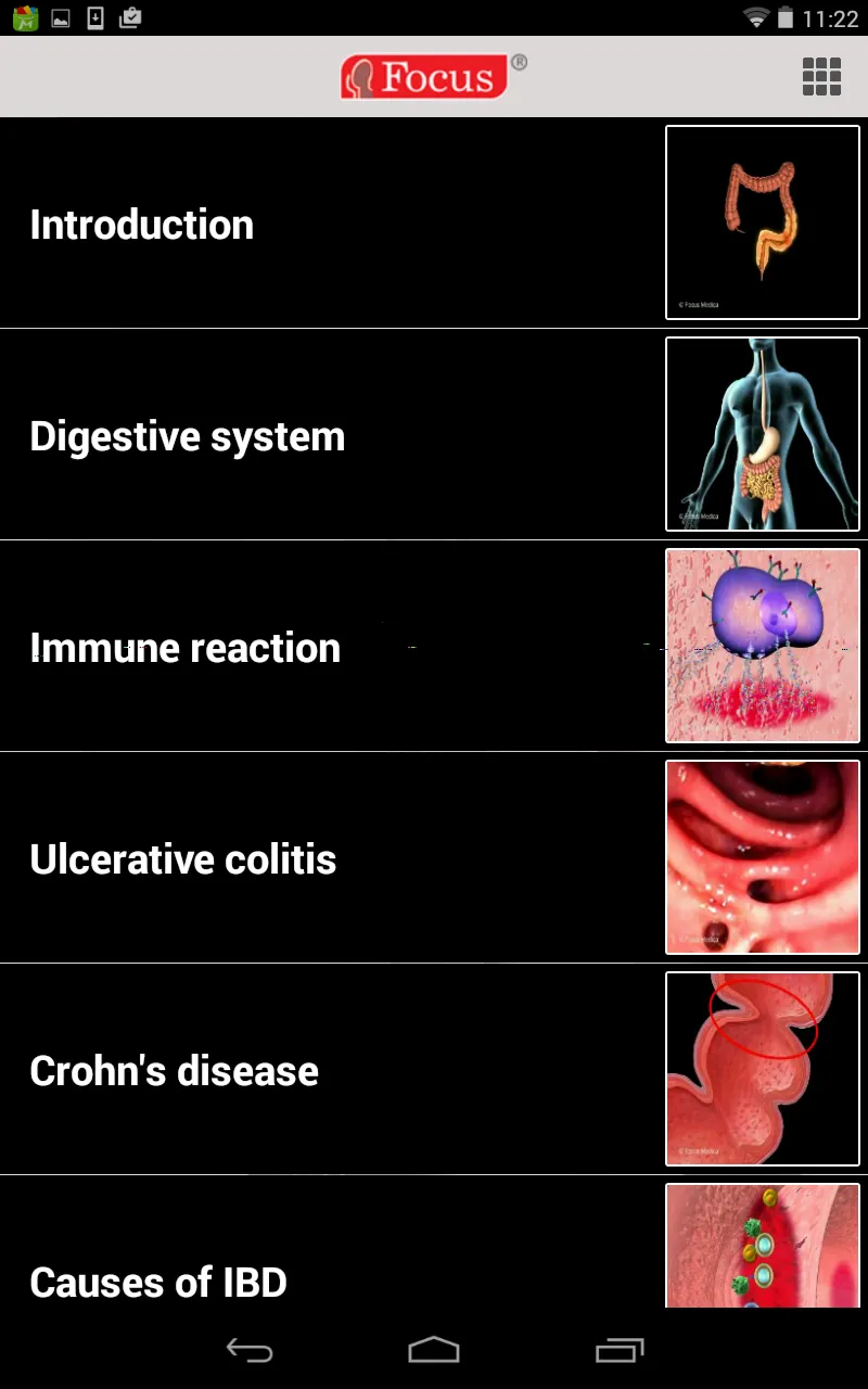 Inflammatory Bowel Disease | Indus Appstore | Screenshot