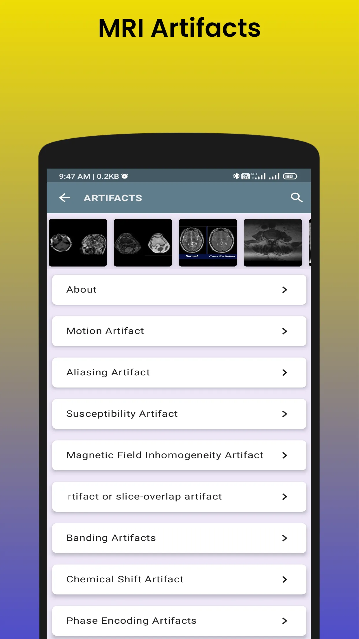 Master in MRI | MRI Scan | Indus Appstore | Screenshot