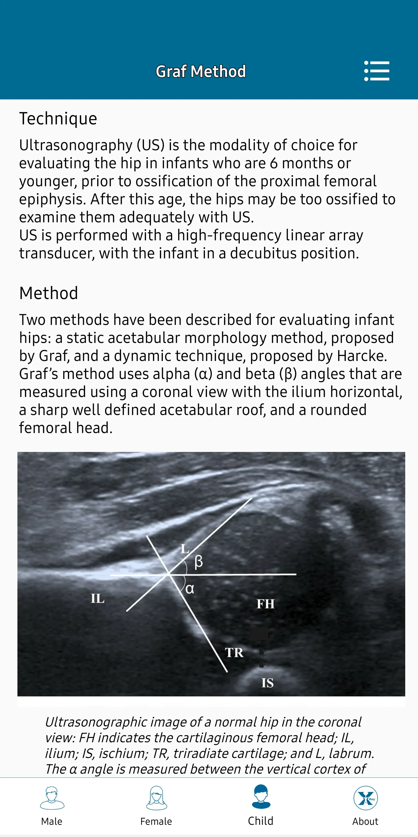 Radiology Measurements | Indus Appstore | Screenshot