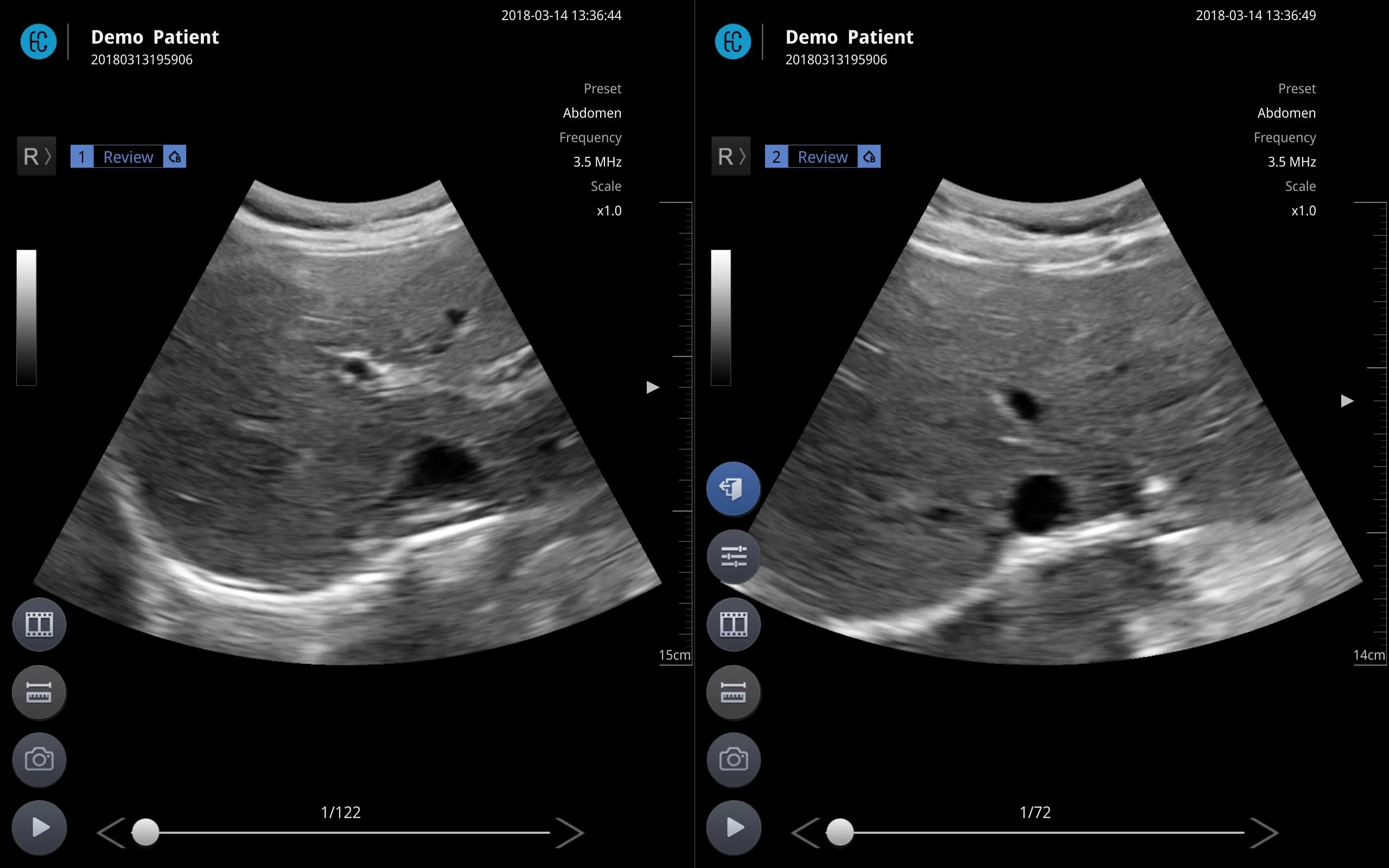 SONON X Ultrasound App | Indus Appstore | Screenshot