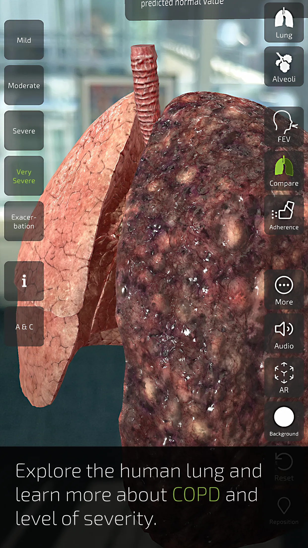 INSIGHT LUNG | Indus Appstore | Screenshot