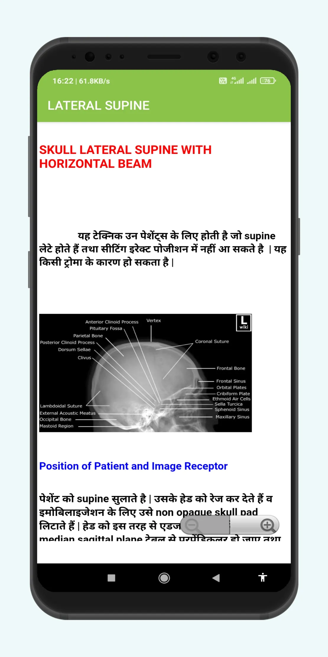 Radiography In Hindi | Indus Appstore | Screenshot