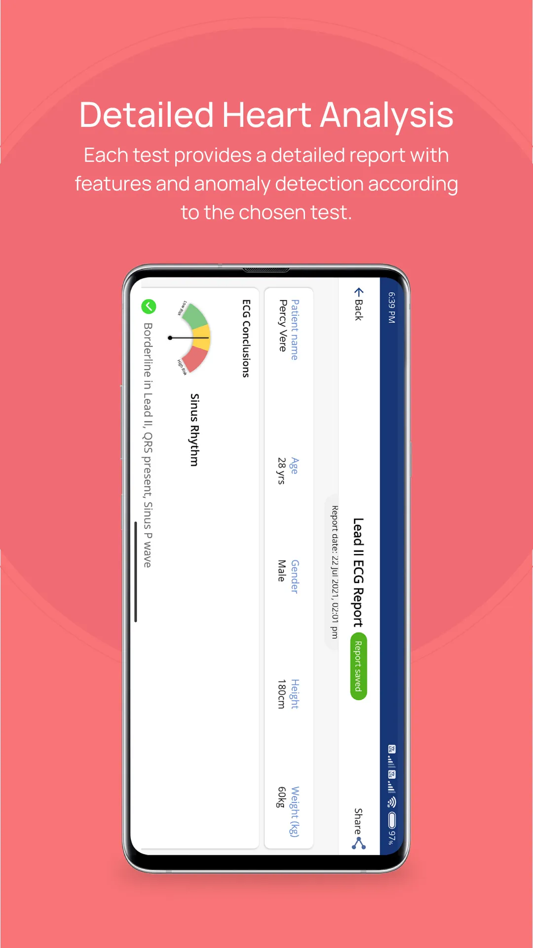 Spandan-ECG/EKG on smartphone | Indus Appstore | Screenshot