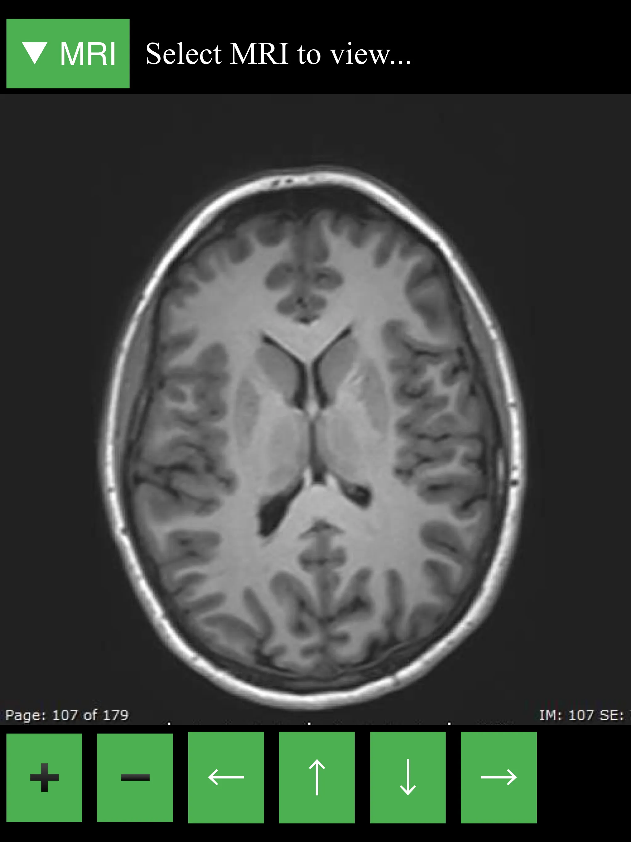 MRI Viewer | Indus Appstore | Screenshot