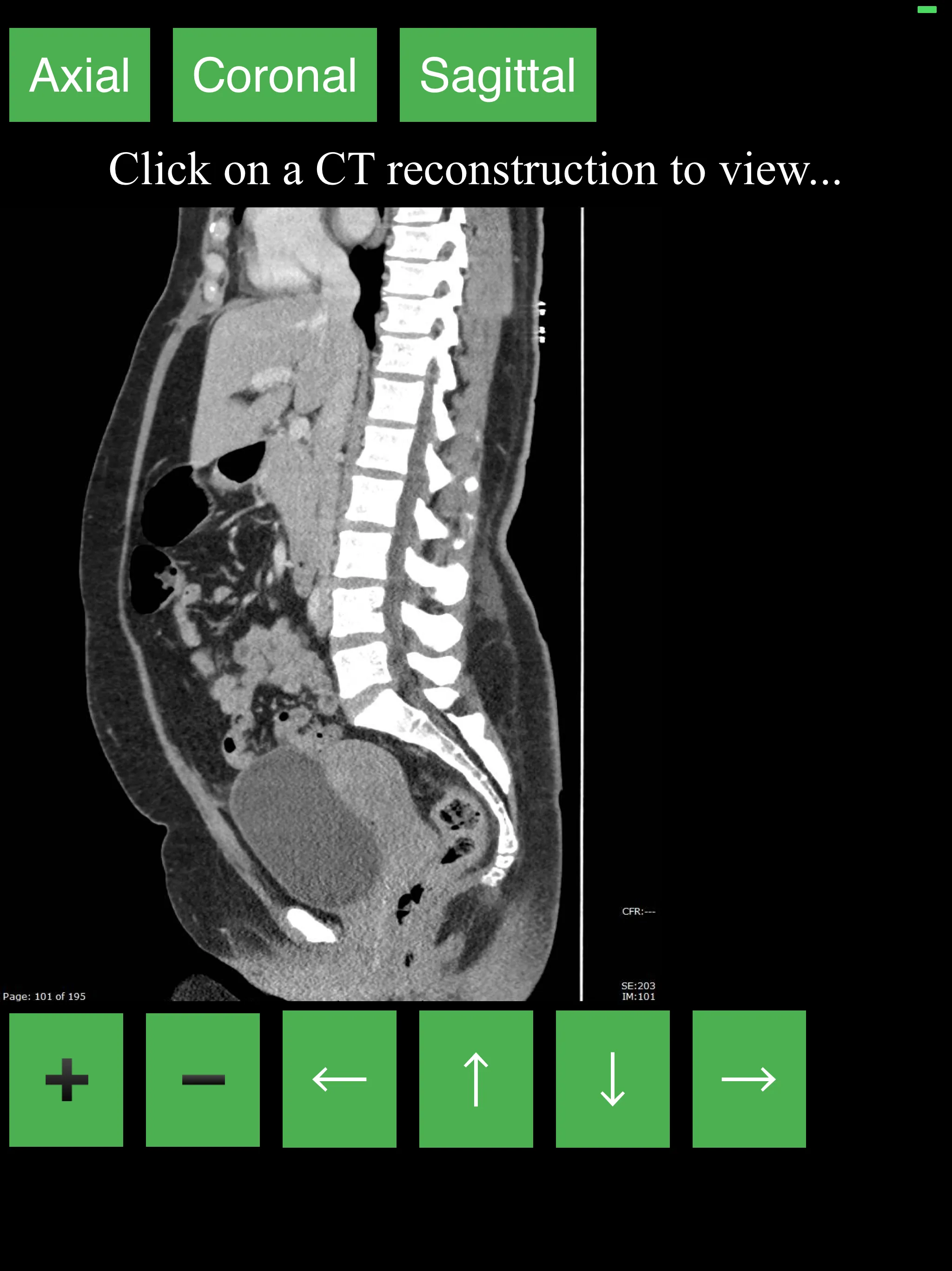 CT Abdomen Pelvis | Indus Appstore | Screenshot