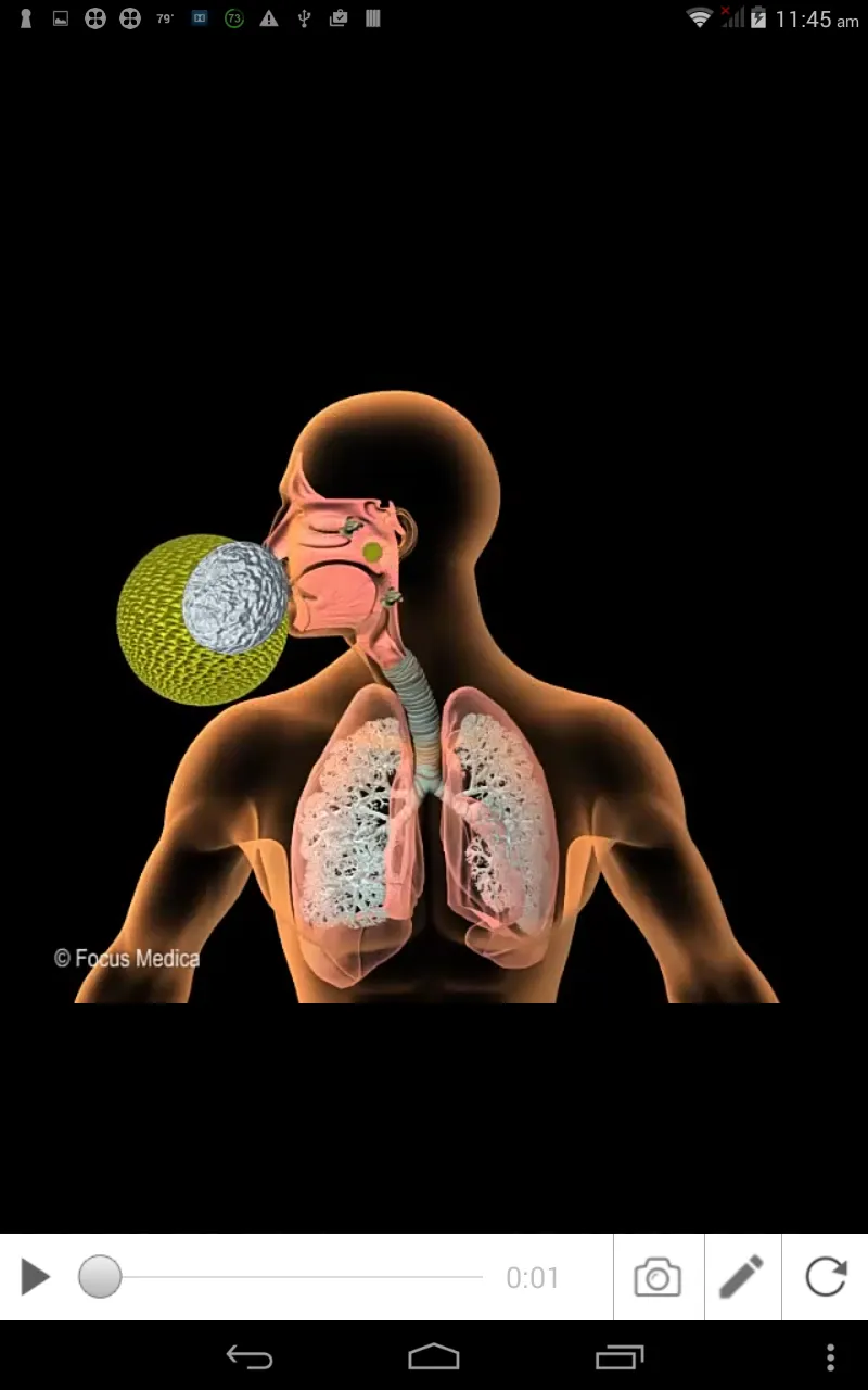 Allergic Rhinitis | Indus Appstore | Screenshot