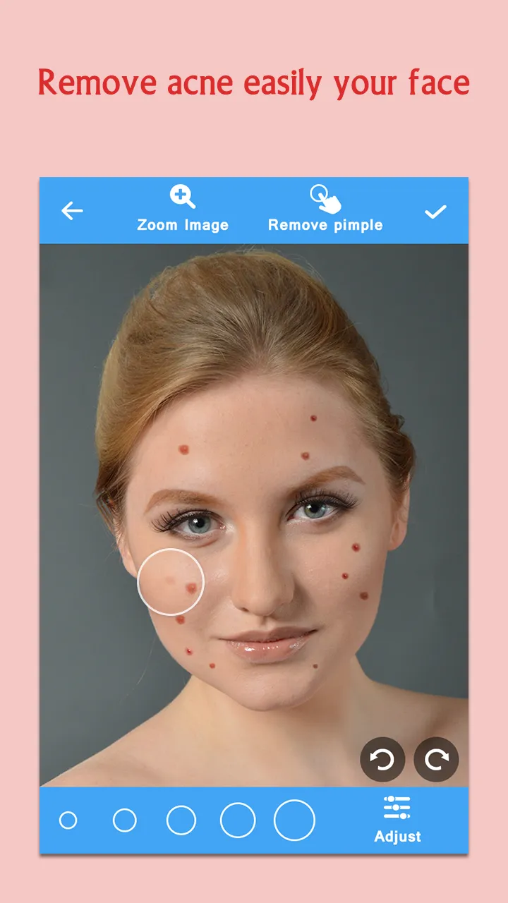 Remove Acne from Face | Indus Appstore | Screenshot