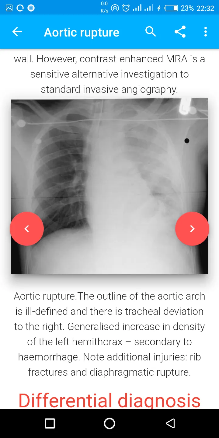 A-Z Chest XRay Pathology Guide | Indus Appstore | Screenshot