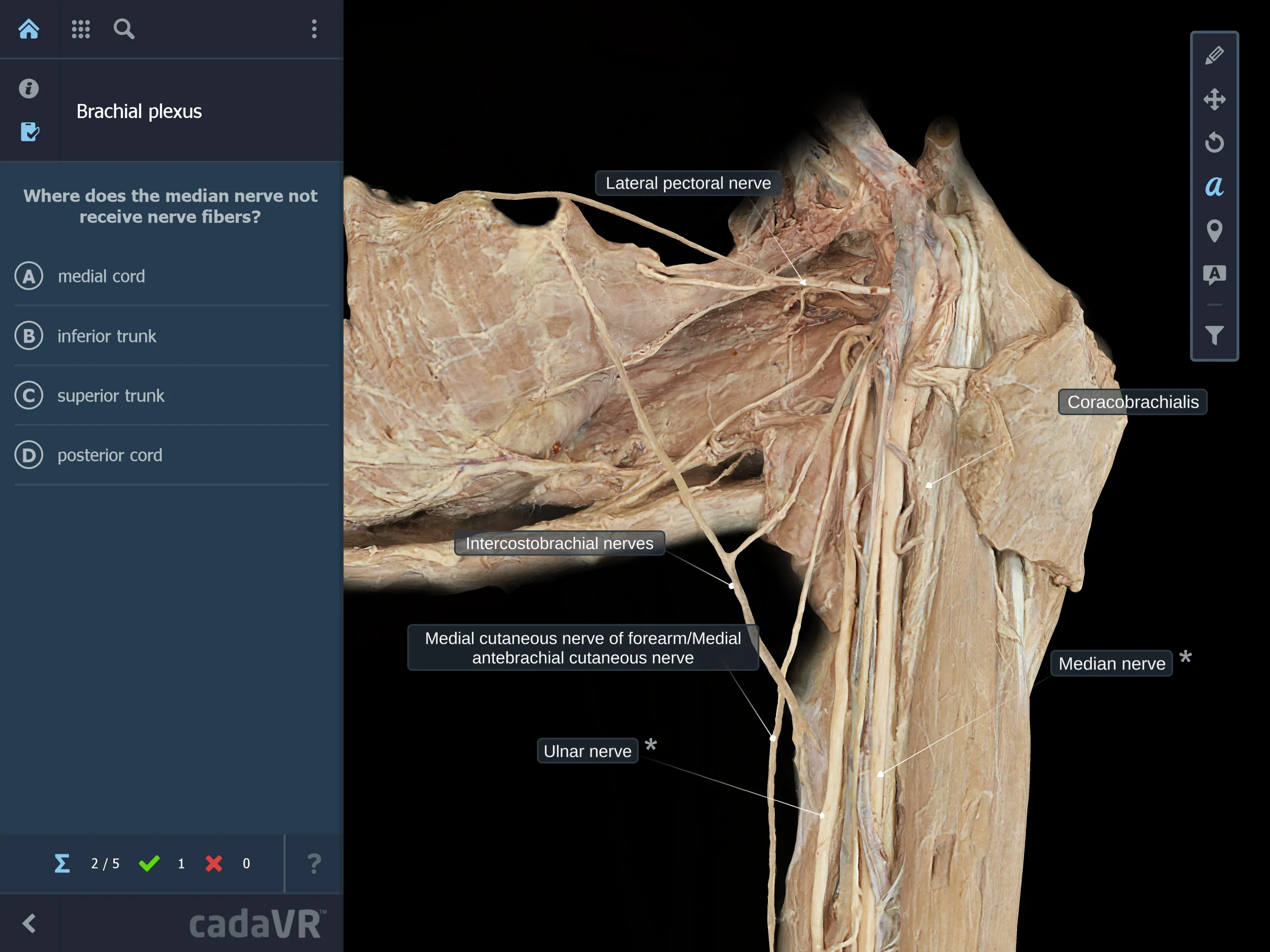 cadaVR anatomy | Indus Appstore | Screenshot