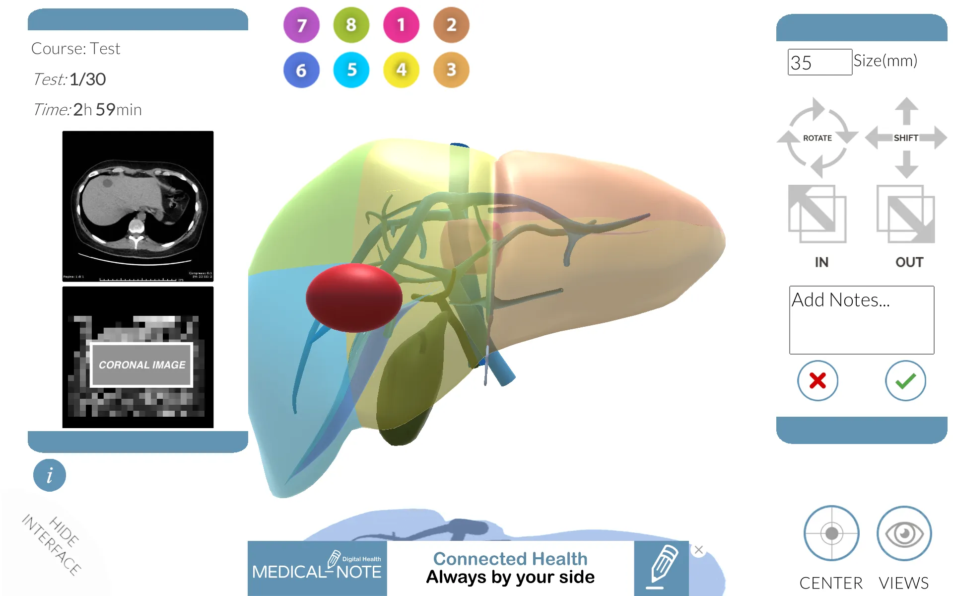 LIVER-NOTE.Edu | Indus Appstore | Screenshot