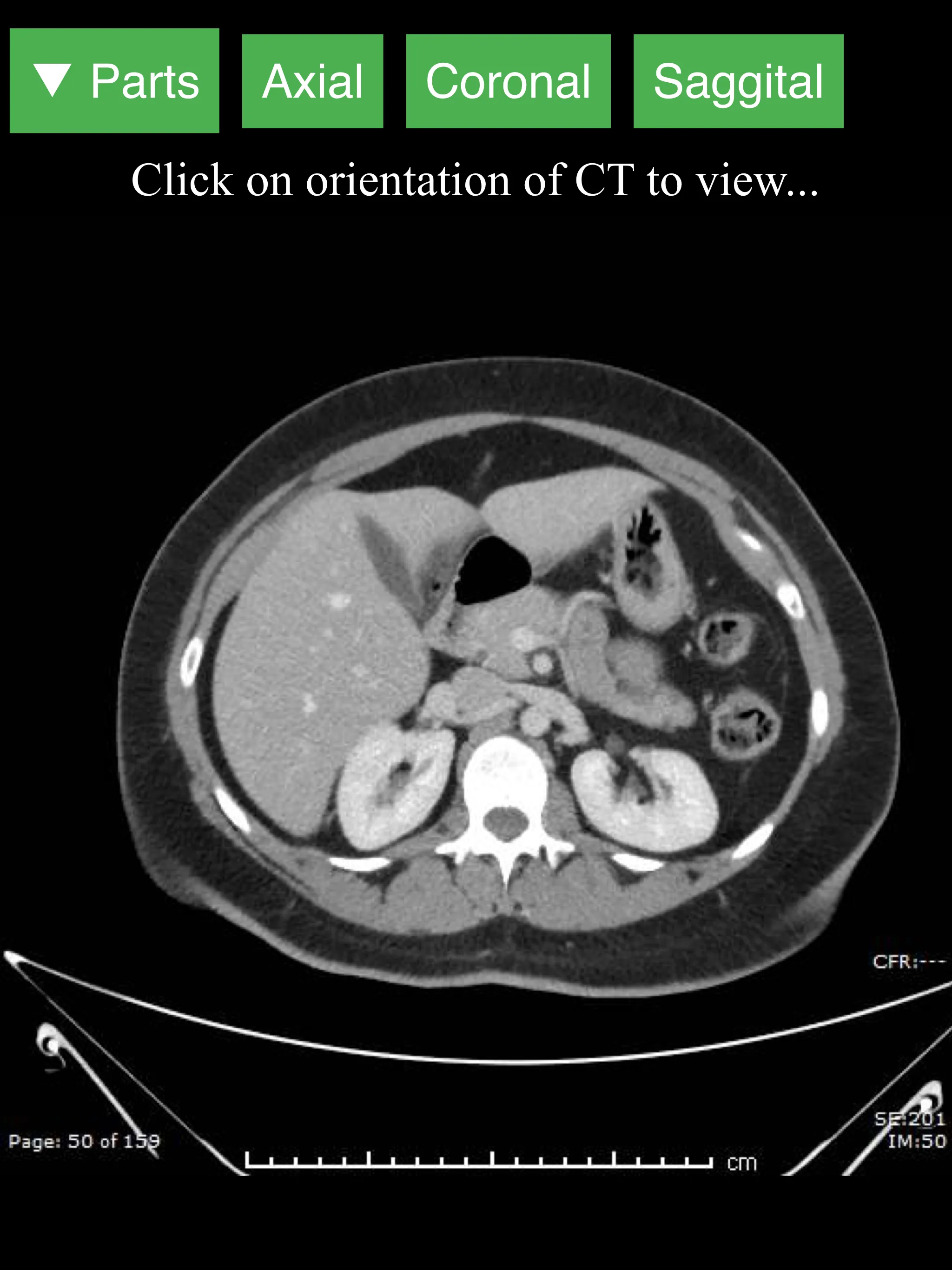 Radiology CT Viewer | Indus Appstore | Screenshot