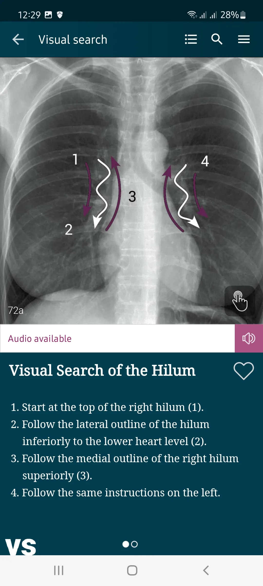 Chest X-Ray DEMO | Indus Appstore | Screenshot