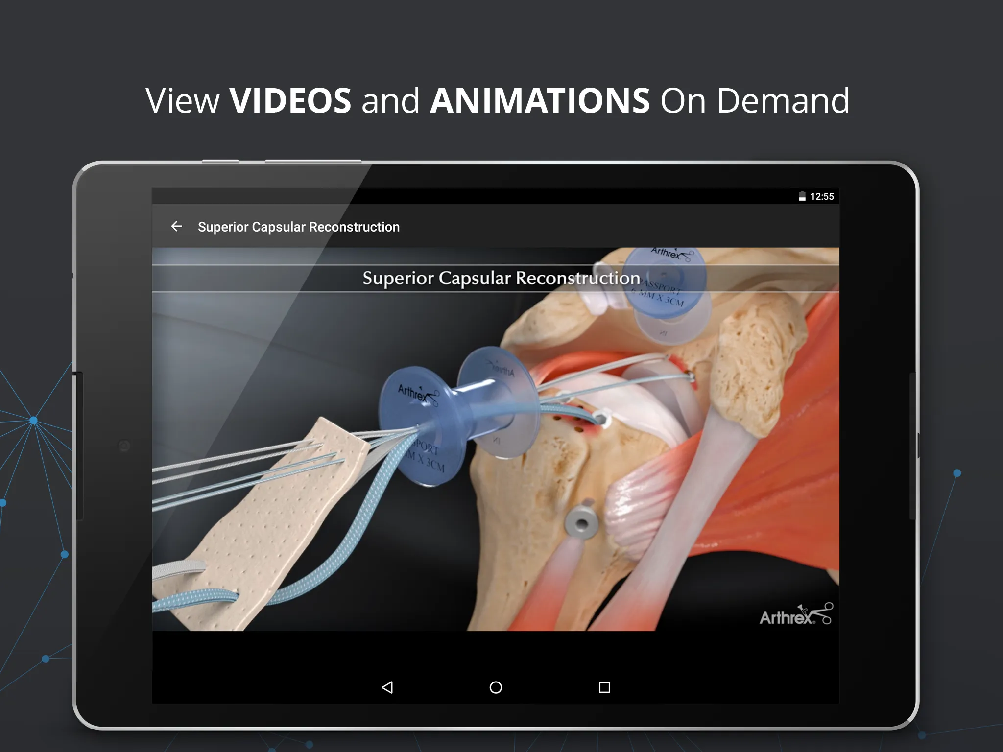 Arthrex Surgeon App | Indus Appstore | Screenshot