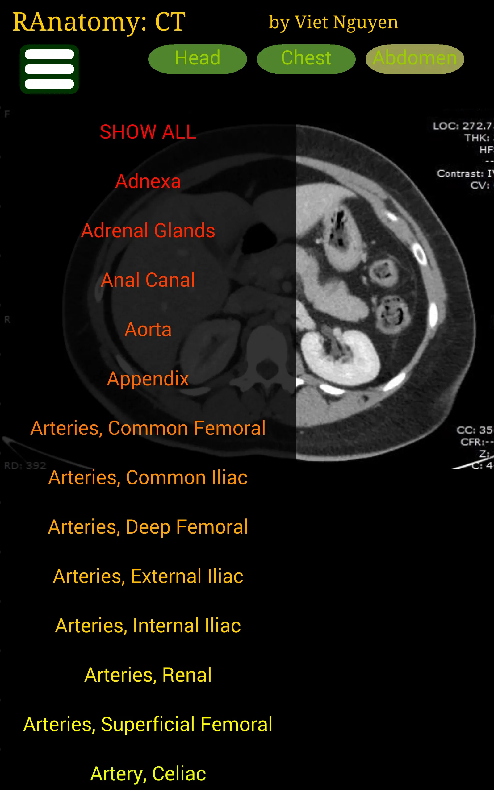 Radiology CT Anatomy | Indus Appstore | Screenshot