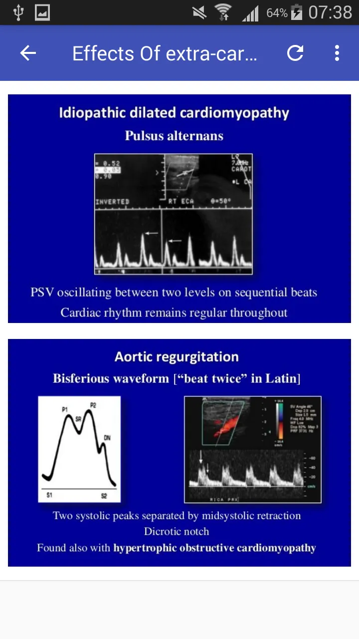 Doppler US Of Carotid arteries | Indus Appstore | Screenshot