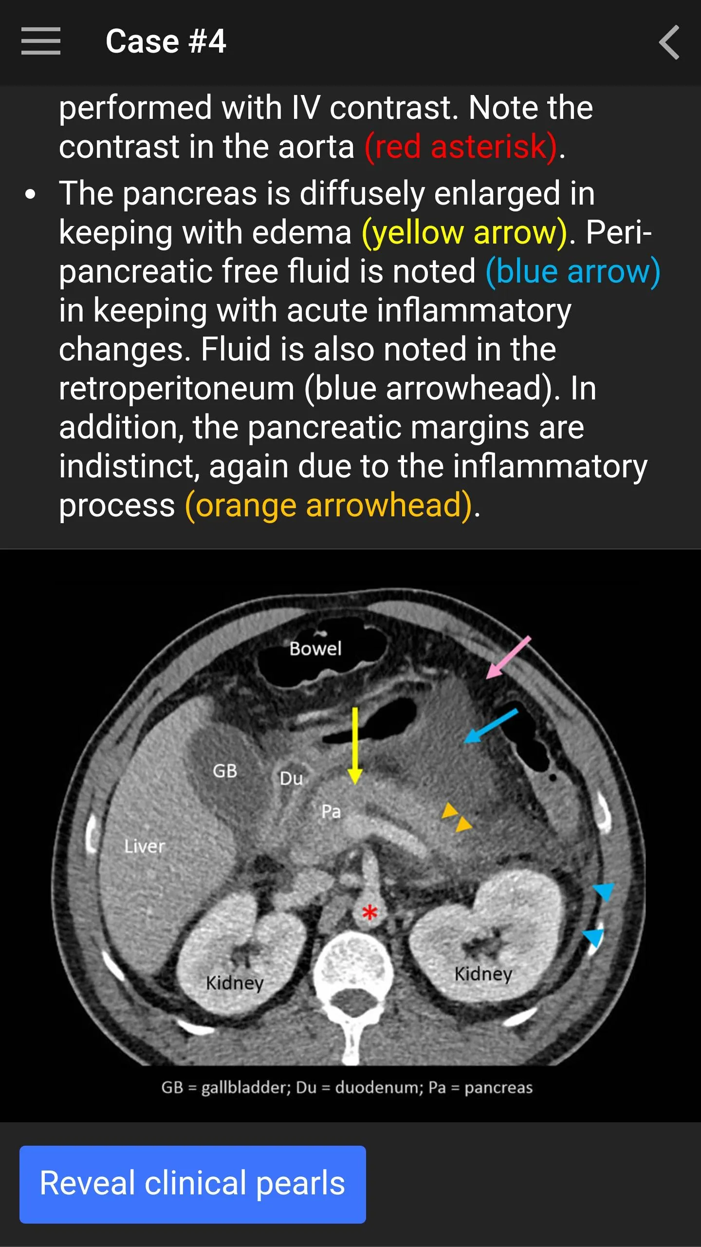 UBC Radiology | Indus Appstore | Screenshot