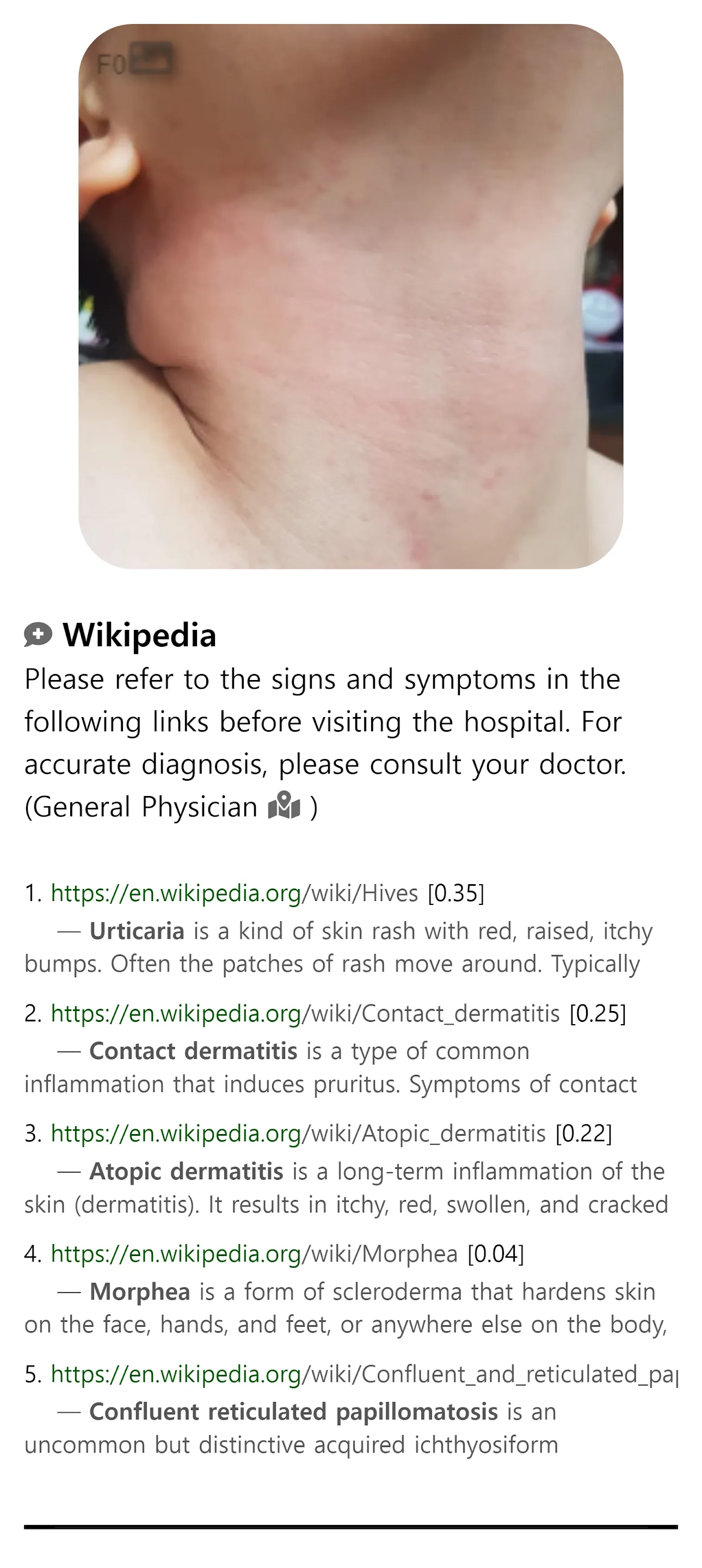 Model Dermatol – Skin Disease | Indus Appstore | Screenshot