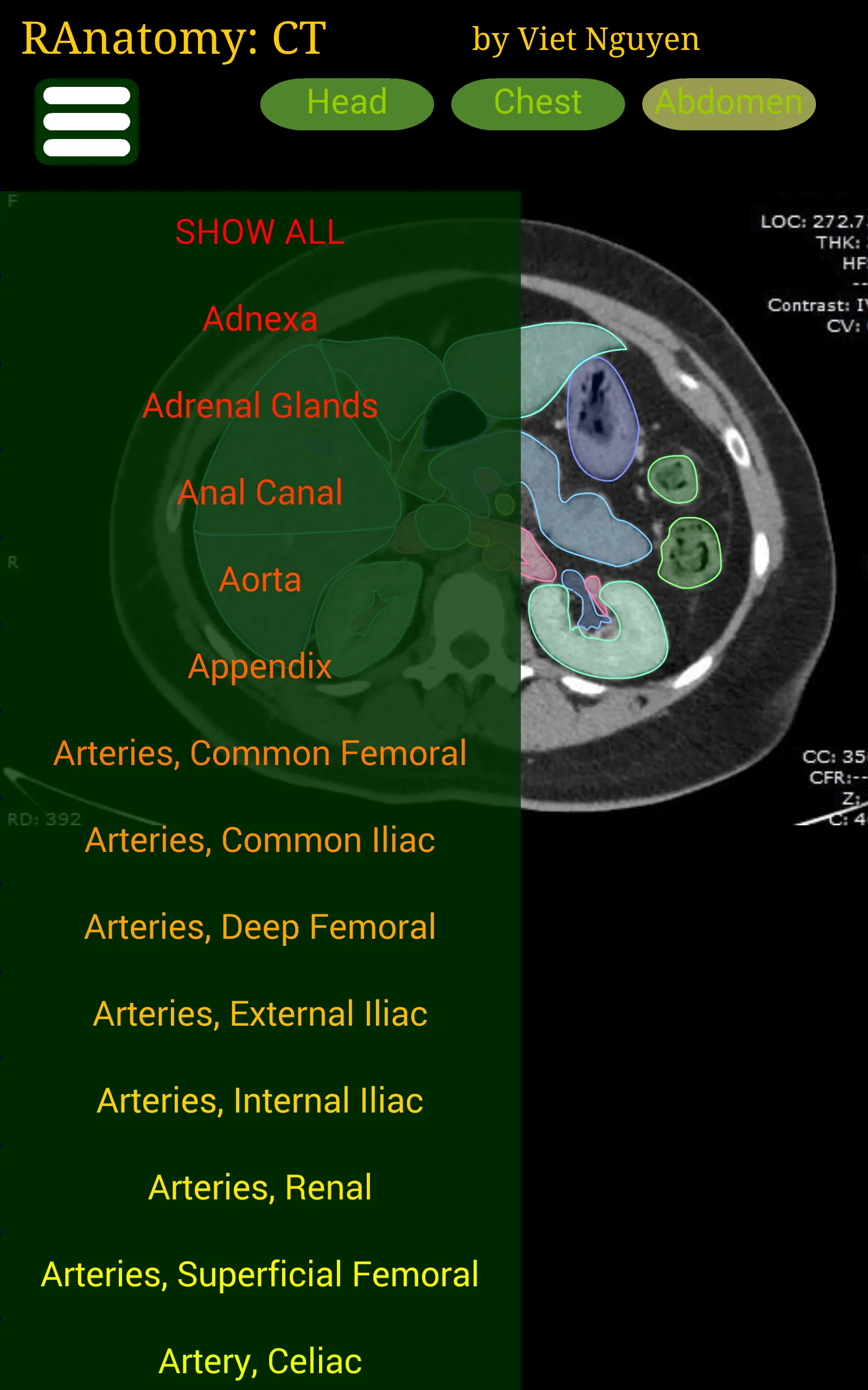 Radiology CT Anatomy | Indus Appstore | Screenshot