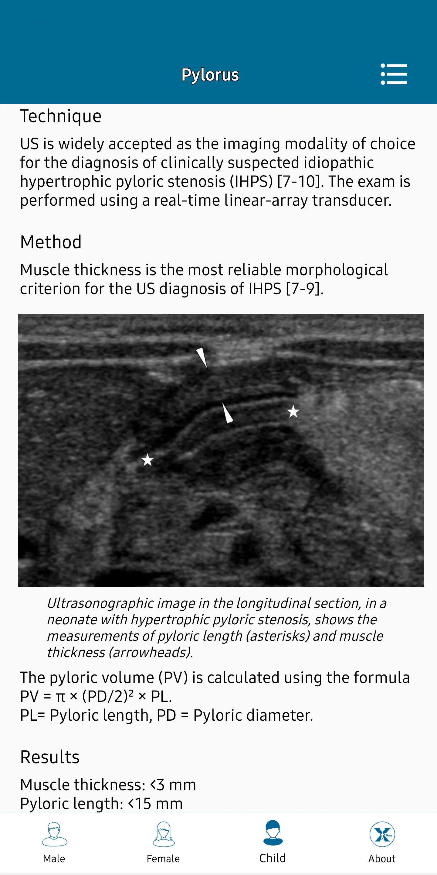 Radiology Measurements | Indus Appstore | Screenshot