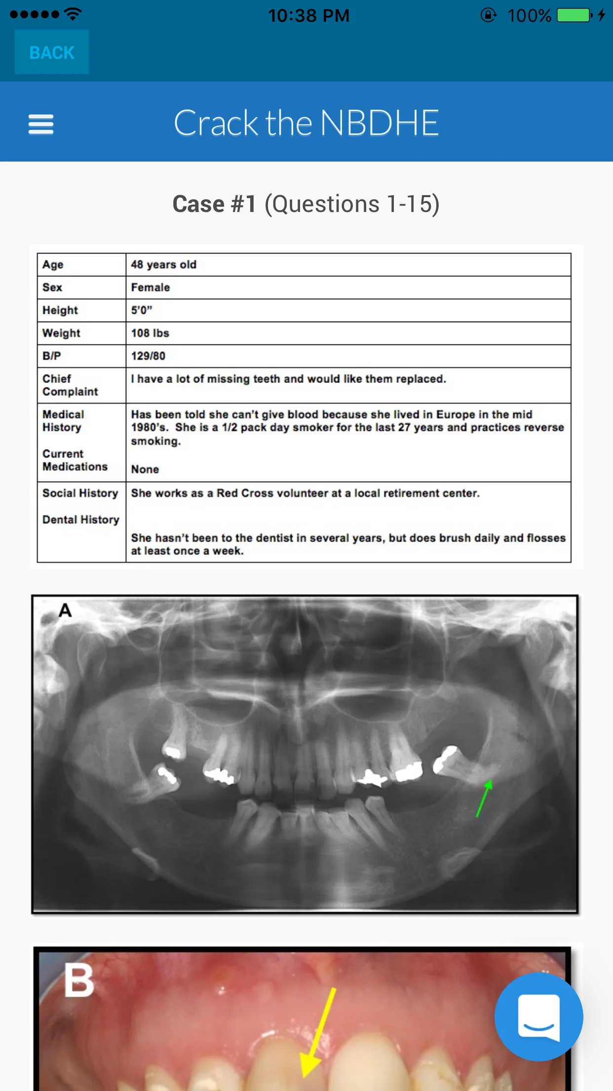 NBDHE - Dental Hygiene Prep | Indus Appstore | Screenshot