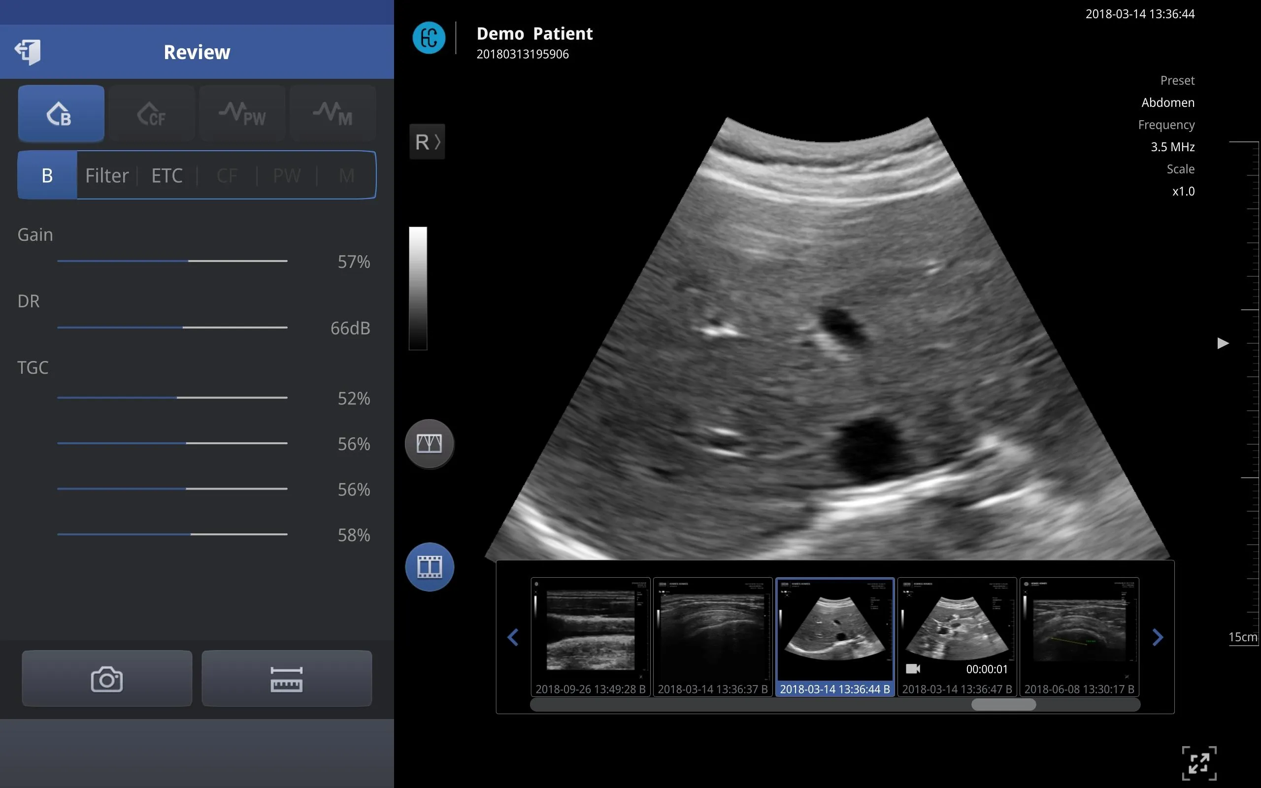 SONON X Ultrasound App | Indus Appstore | Screenshot