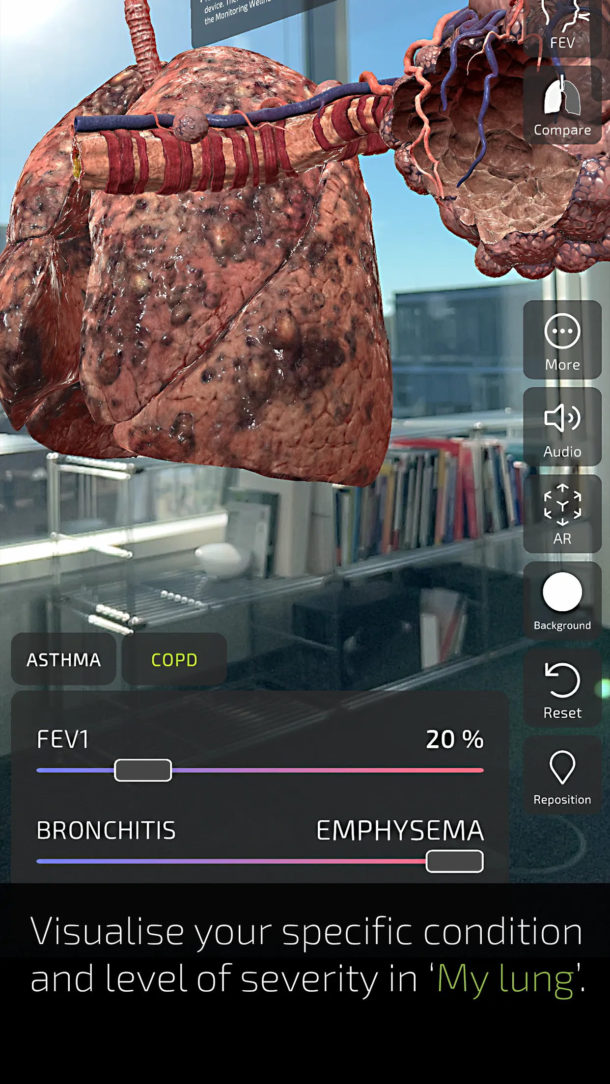 INSIGHT LUNG | Indus Appstore | Screenshot