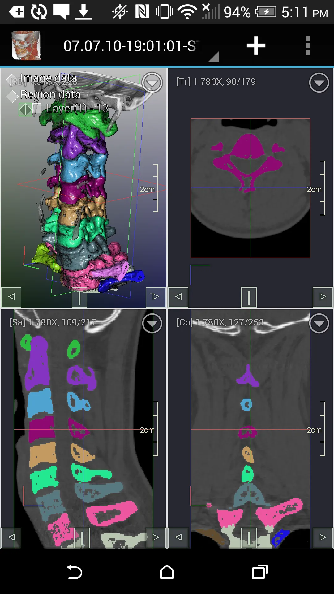 DroidRender - 3D DICOM viewer | Indus Appstore | Screenshot