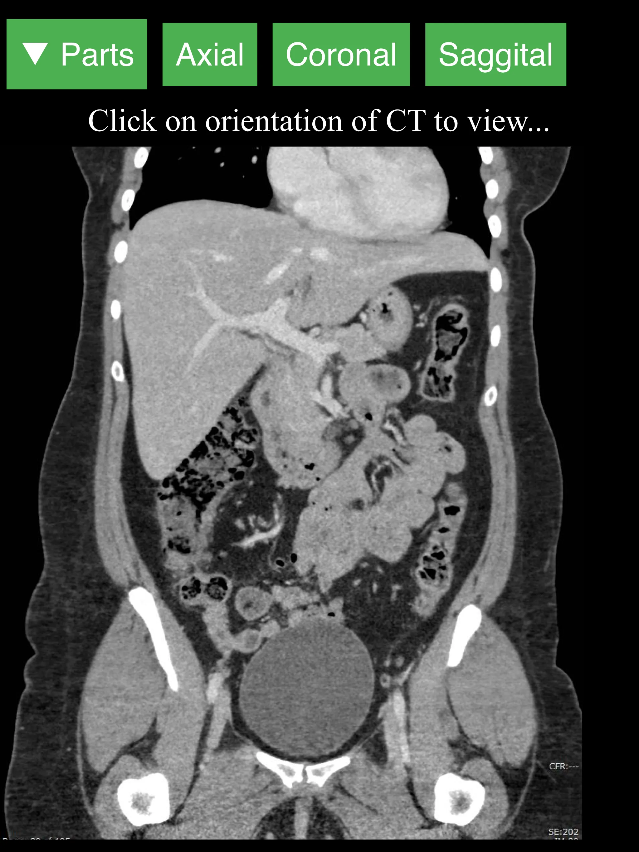 Radiology CT Viewer | Indus Appstore | Screenshot