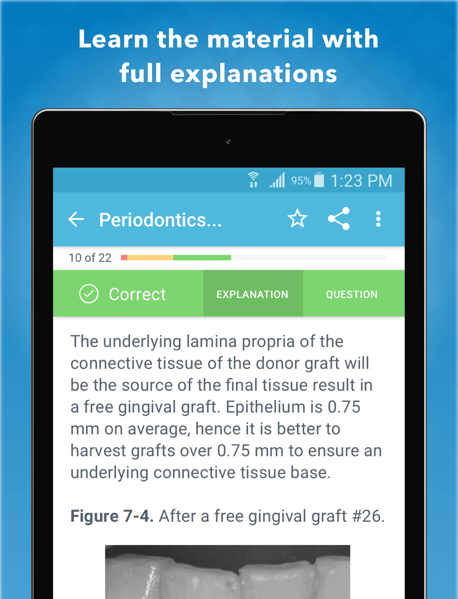 NBDE Part 2: Dental Boards Q&A | Indus Appstore | Screenshot