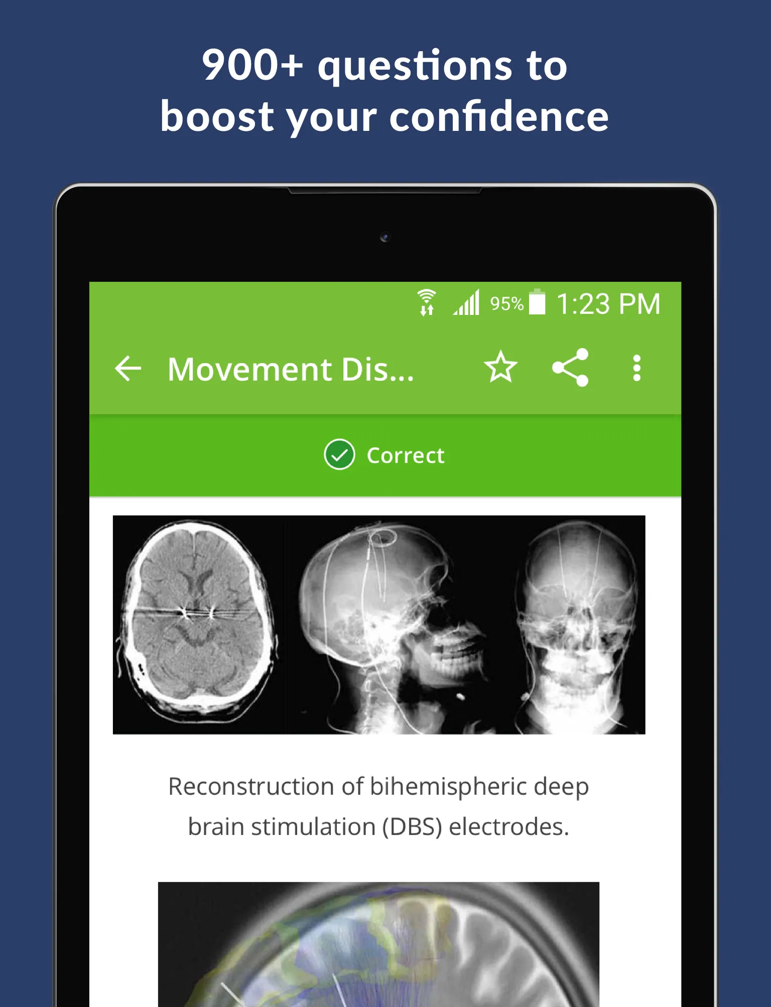 Neurology Exam Review & Practi | Indus Appstore | Screenshot