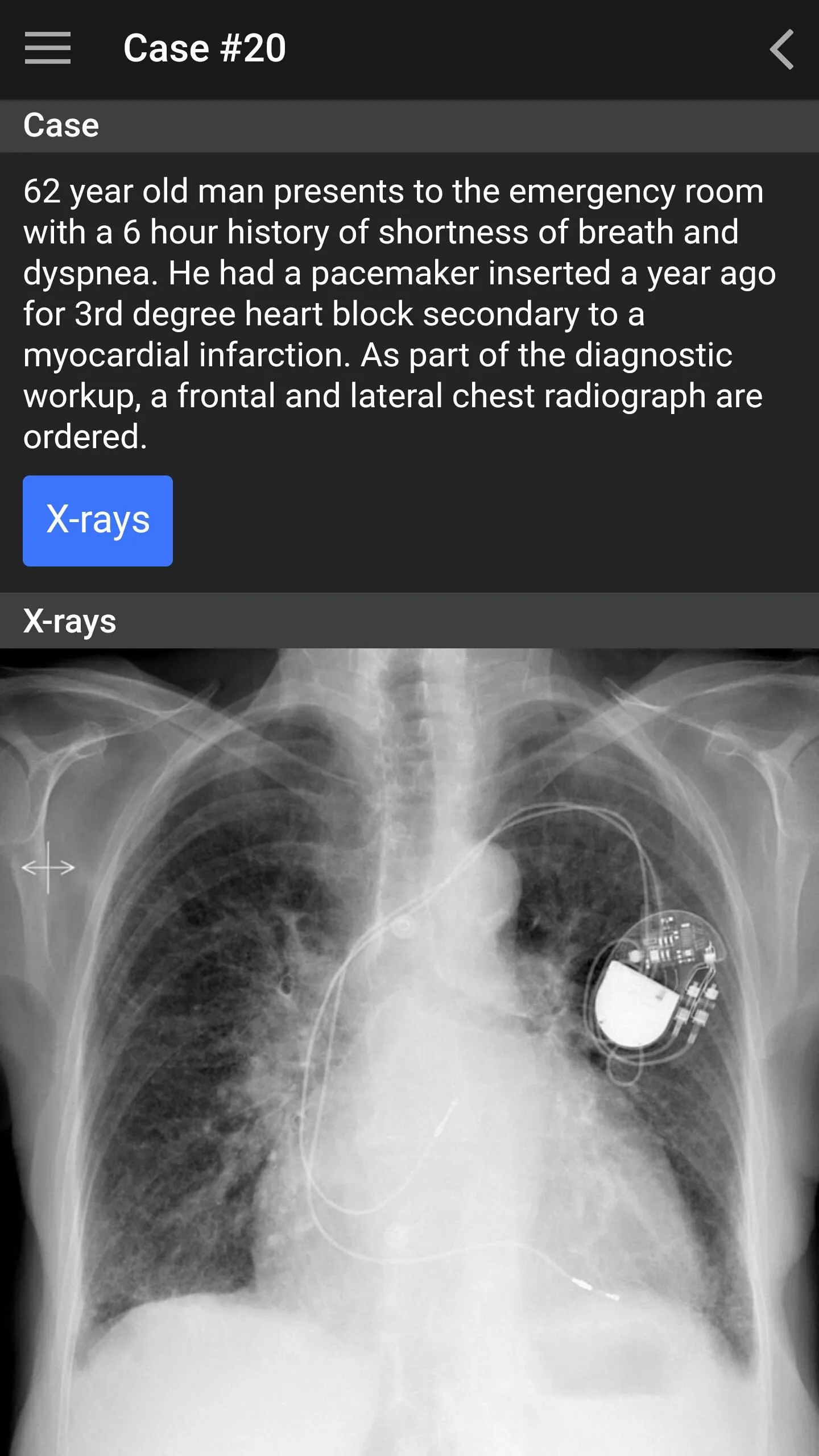 UBC Radiology | Indus Appstore | Screenshot