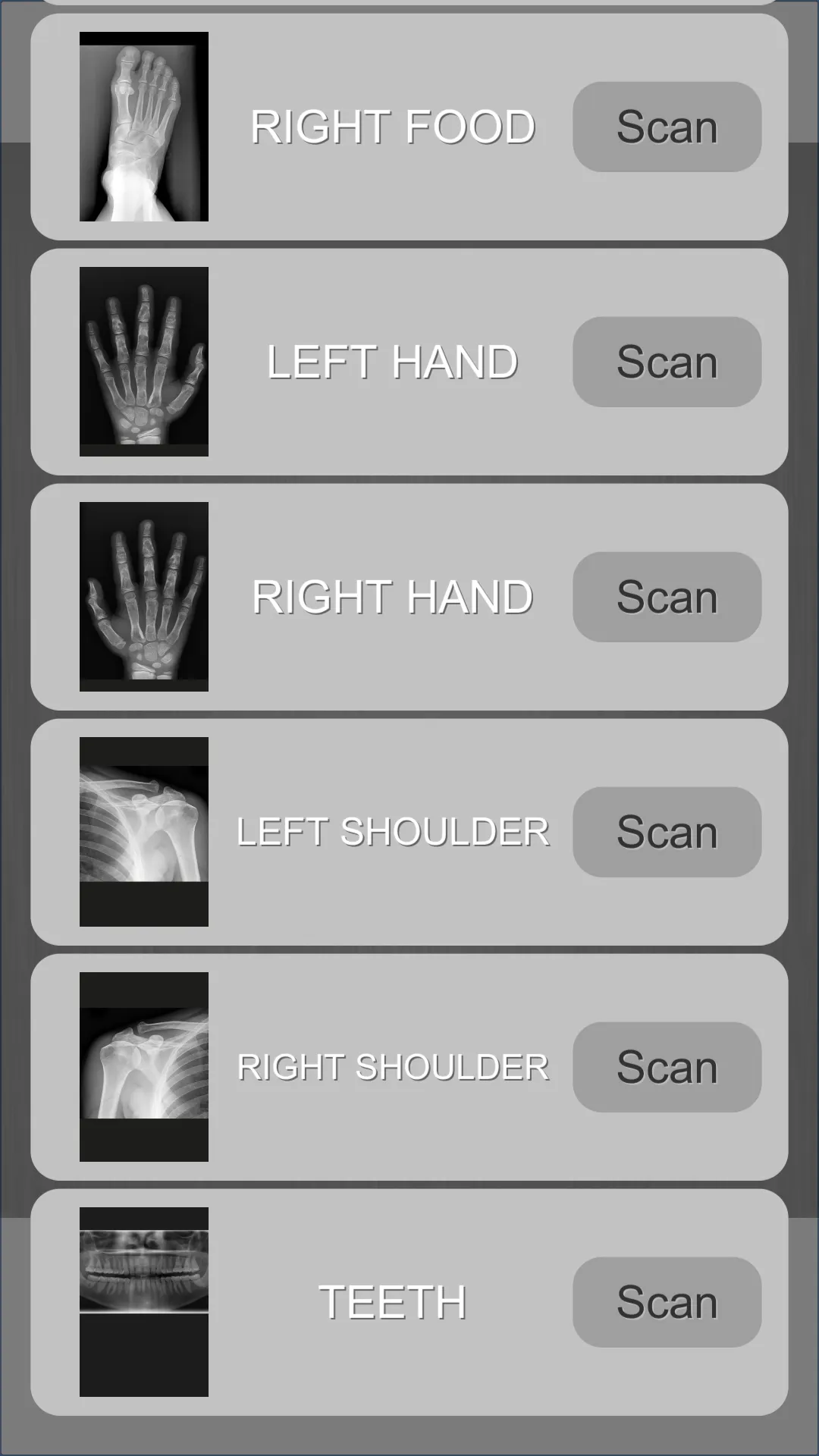 Xray scan filter camera | Indus Appstore | Screenshot