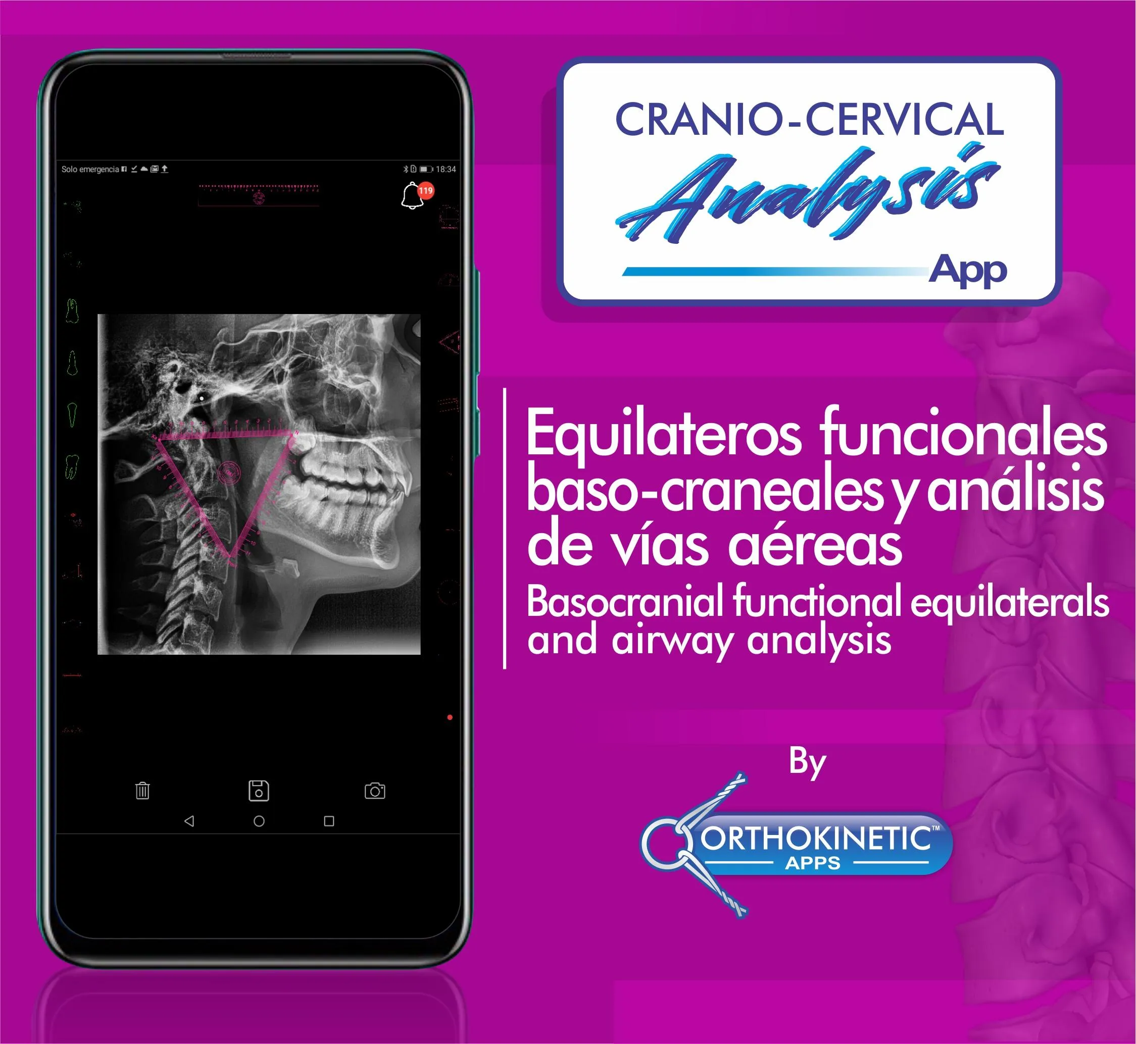 Cranio-cervical Analysis by Or | Indus Appstore | Screenshot