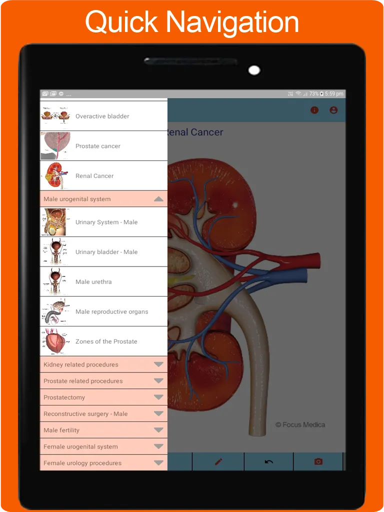 Silodal - Atlas of Urology | Indus Appstore | Screenshot