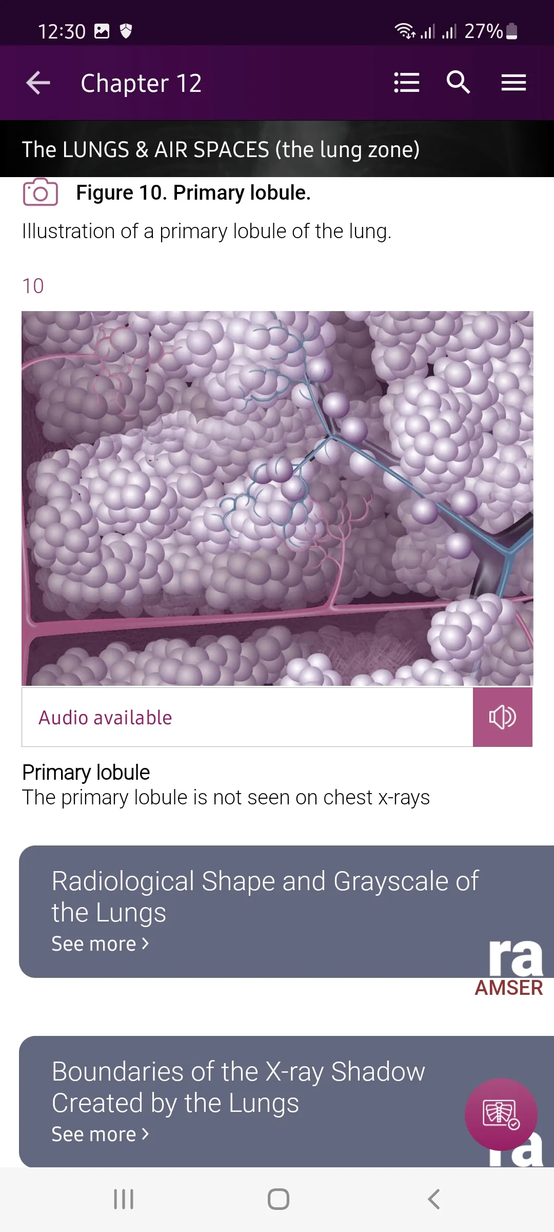 Chest X-Ray DEMO | Indus Appstore | Screenshot