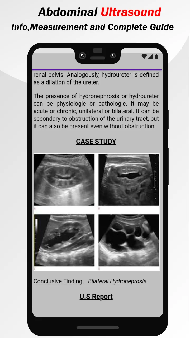 Abdominal Ultrasound Guide | Indus Appstore | Screenshot