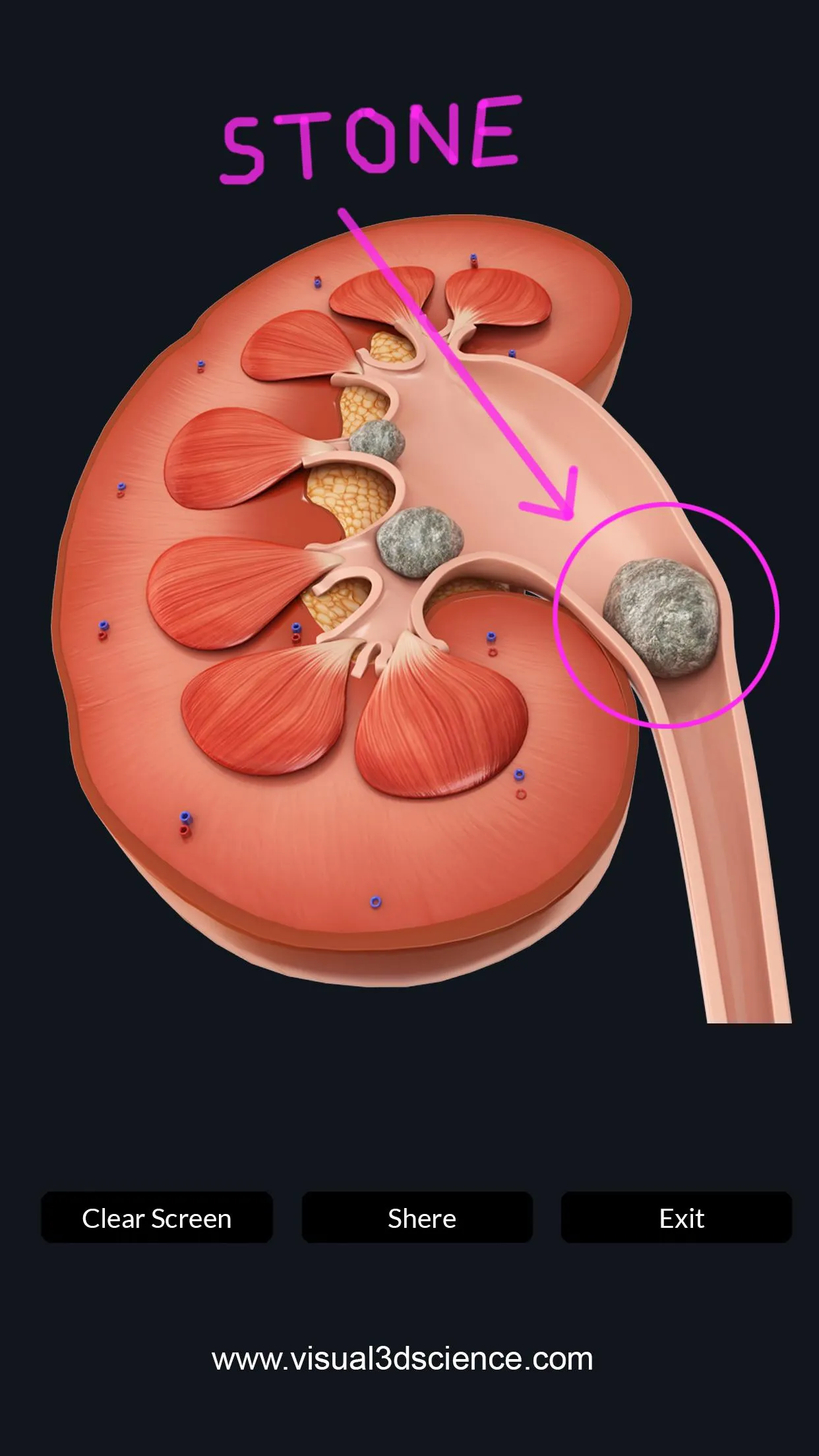 My Urinary System | Indus Appstore | Screenshot