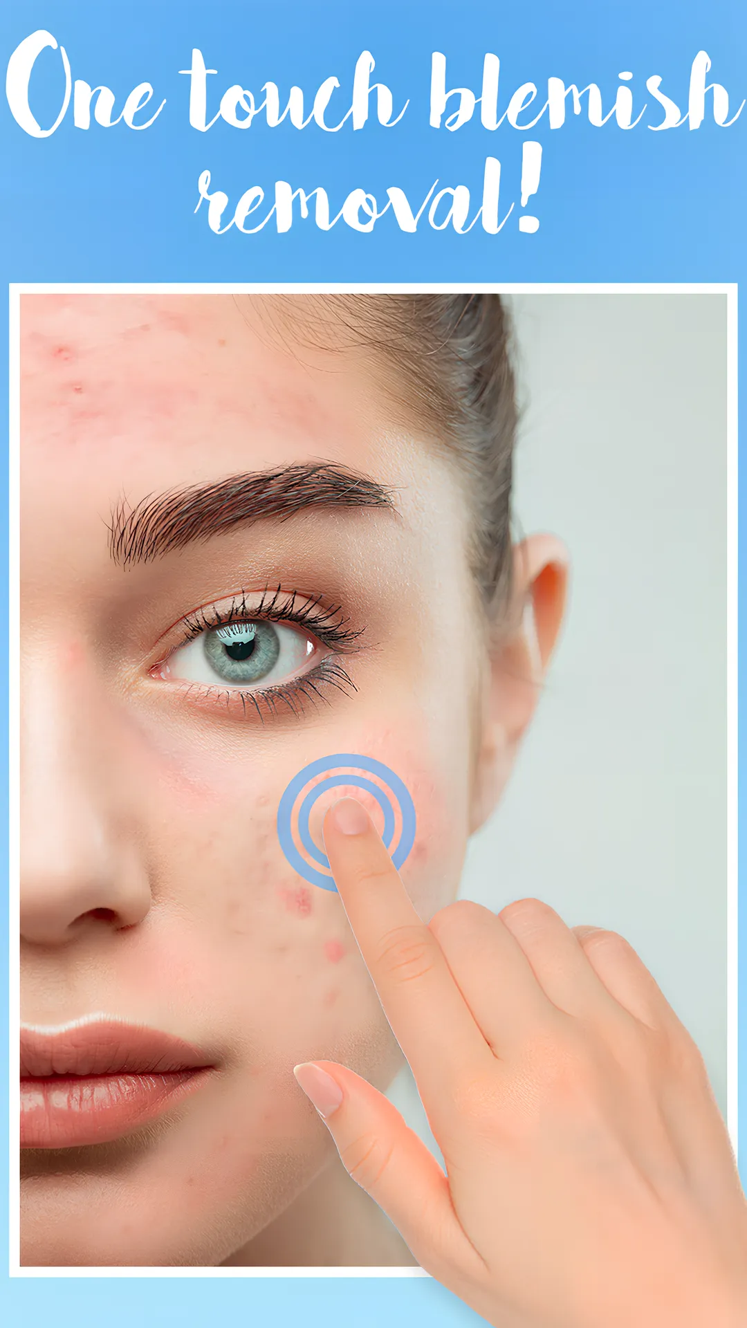 Blemishes Removal | Indus Appstore | Screenshot