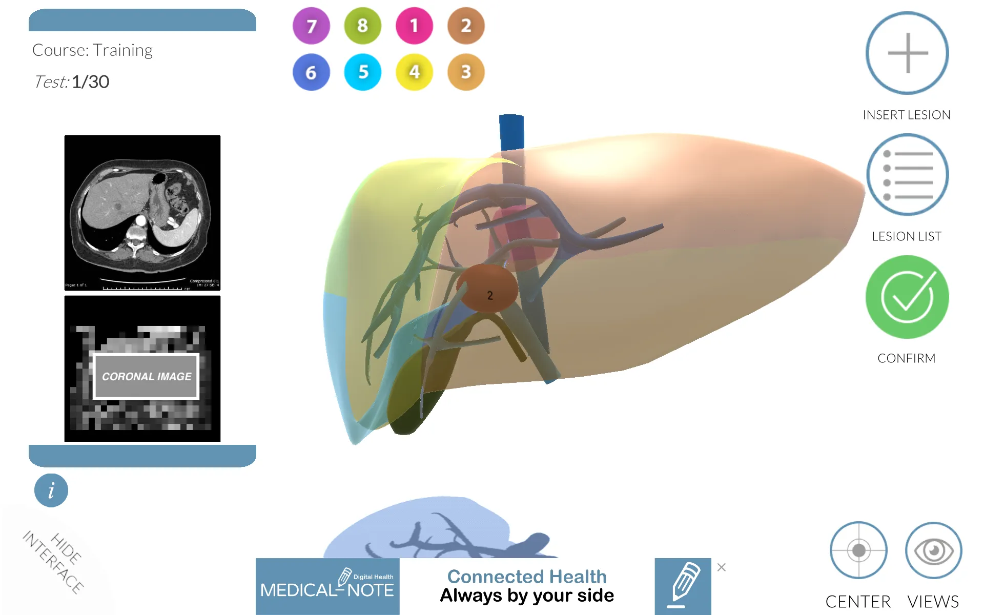 LIVER-NOTE.Edu | Indus Appstore | Screenshot