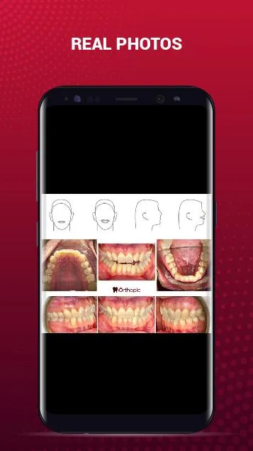 OrthoPic: HD Dental Images | Indus Appstore | Screenshot