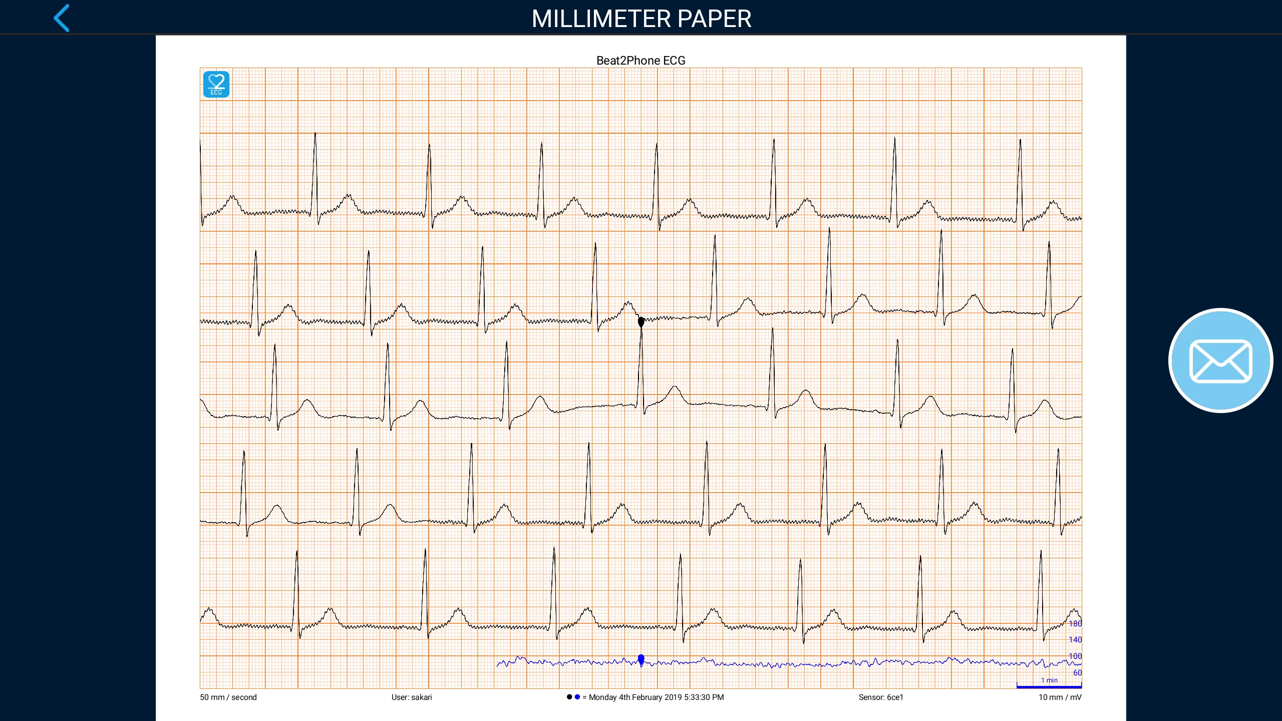 Beat2Phone ECG | Indus Appstore | Screenshot