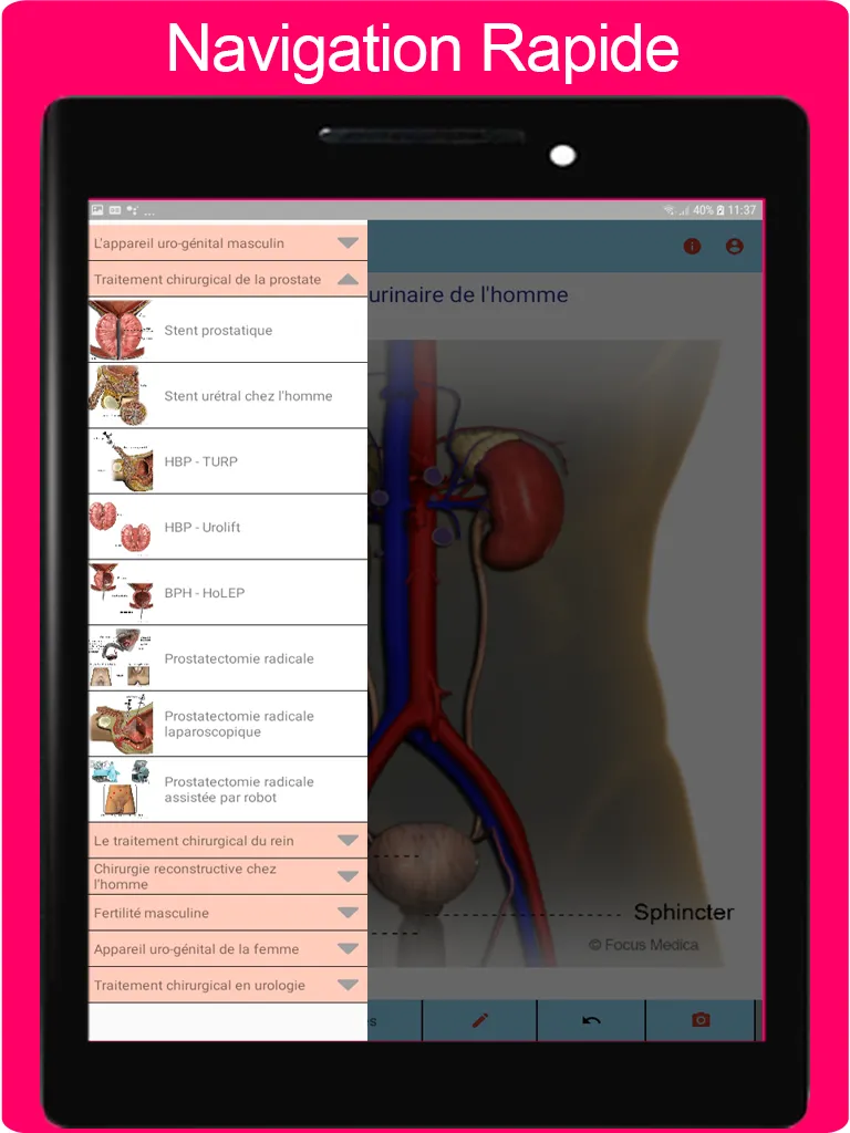 Atlas d'urologie | Indus Appstore | Screenshot