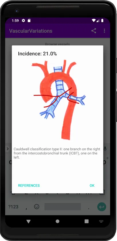 Vascular Variants | Indus Appstore | Screenshot