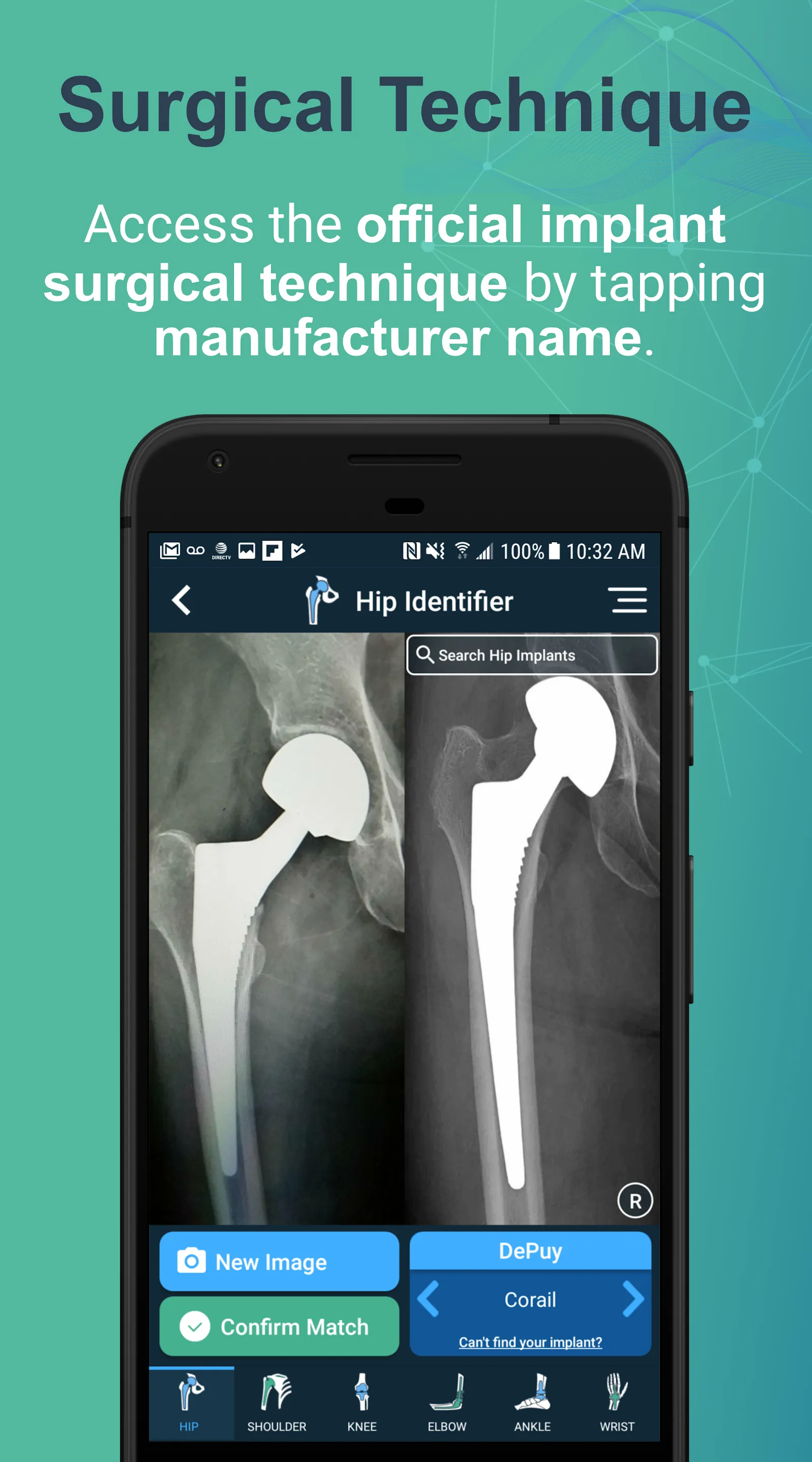 Implant Identifier | Indus Appstore | Screenshot