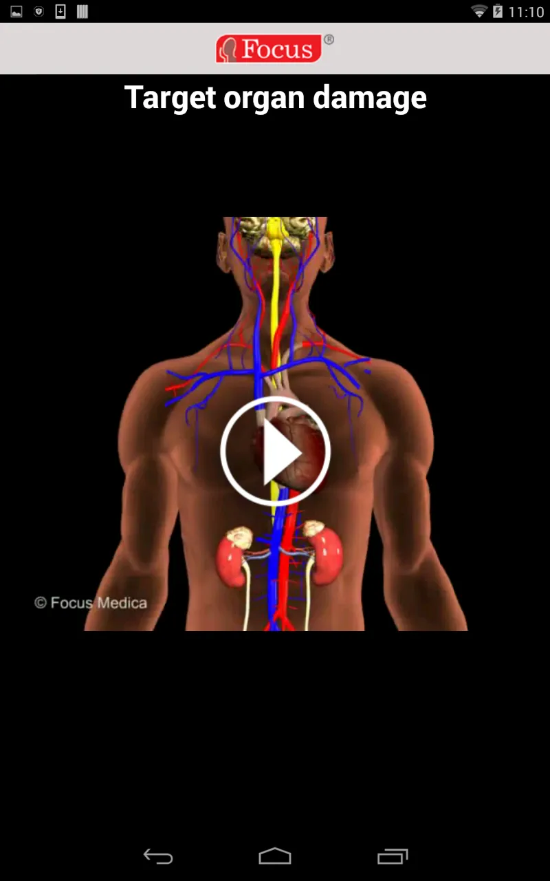 Hypertension (An Overview) | Indus Appstore | Screenshot