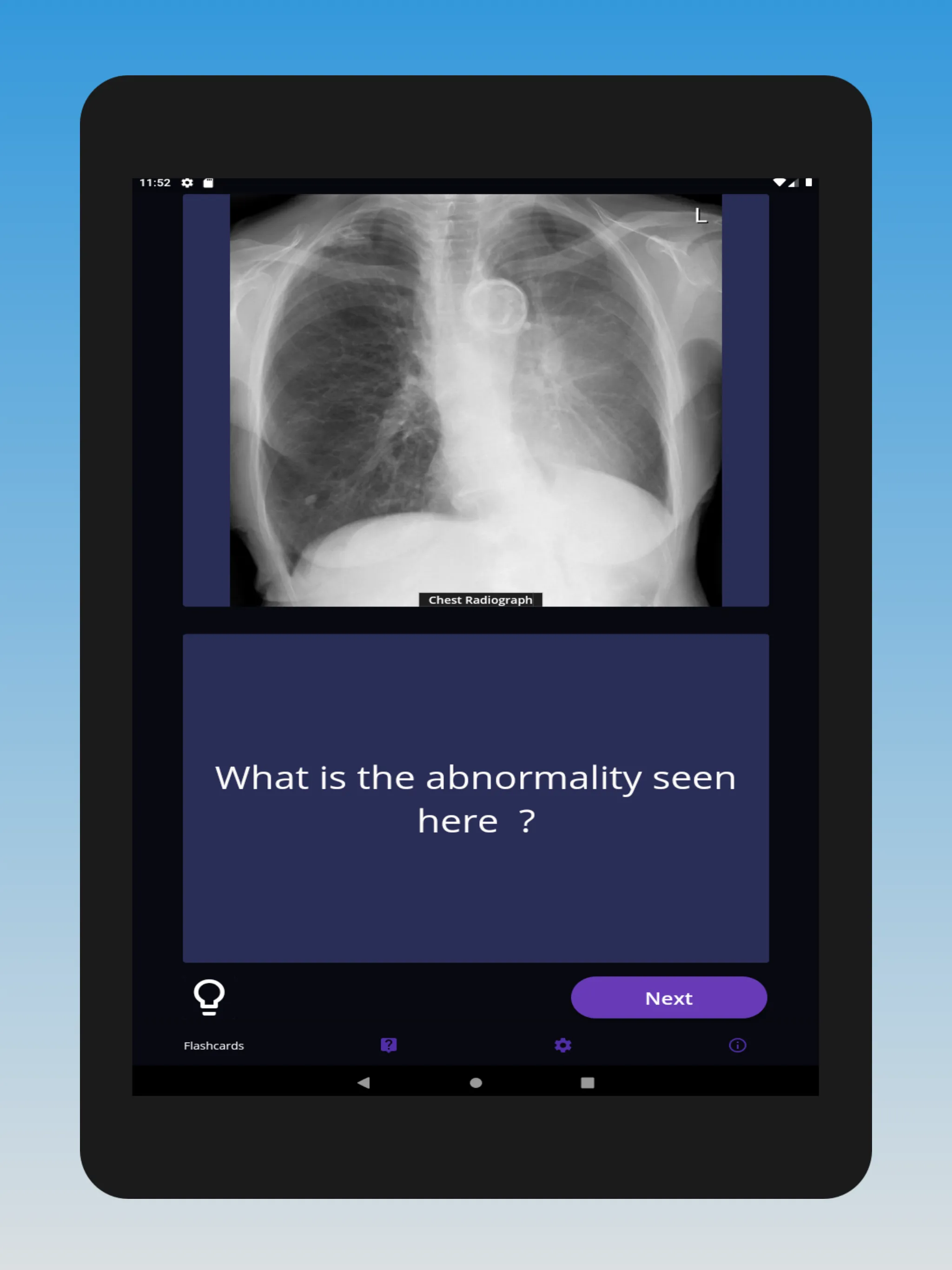 Basic Radiology | Indus Appstore | Screenshot